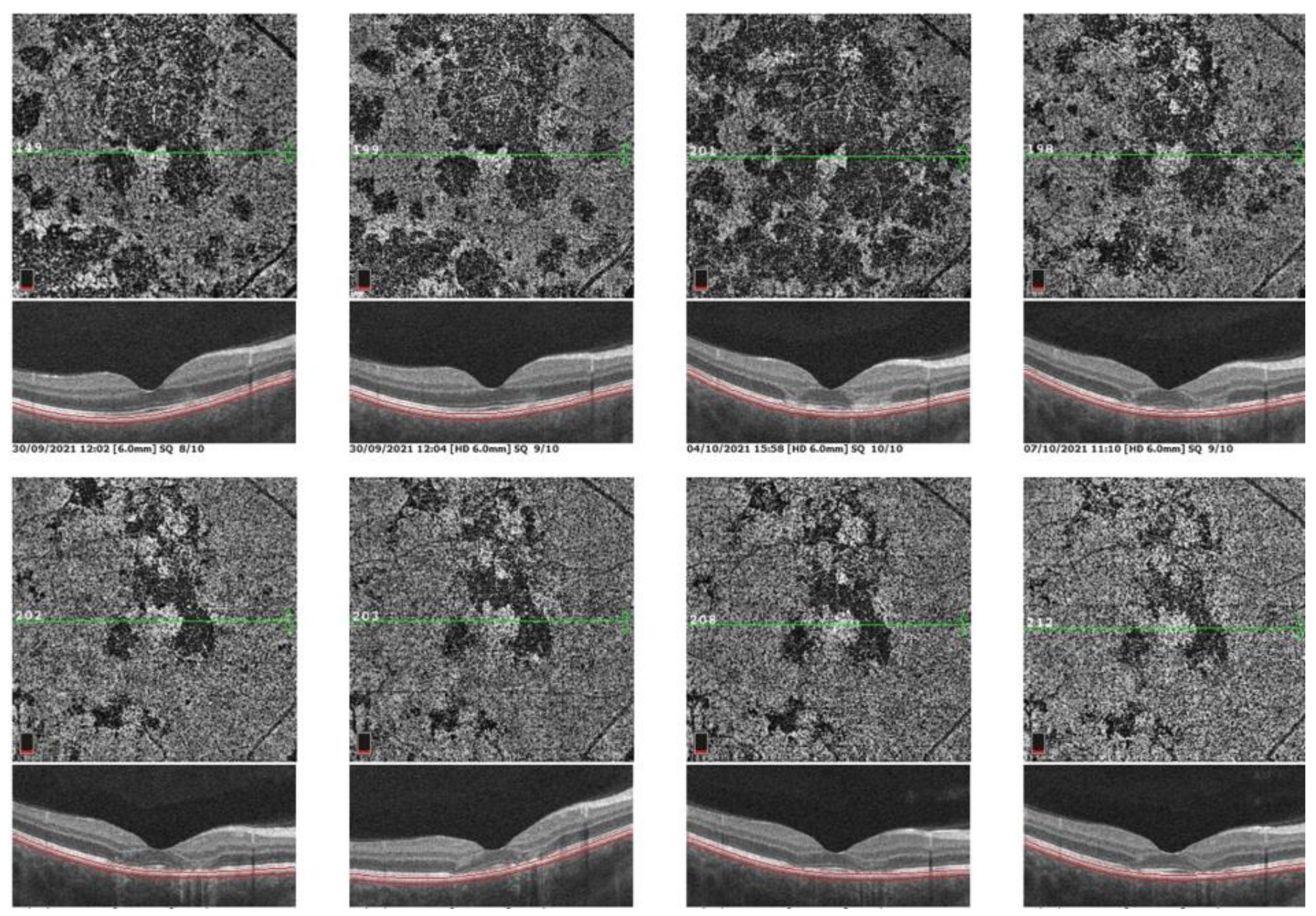 Medicina 58 00165 g012