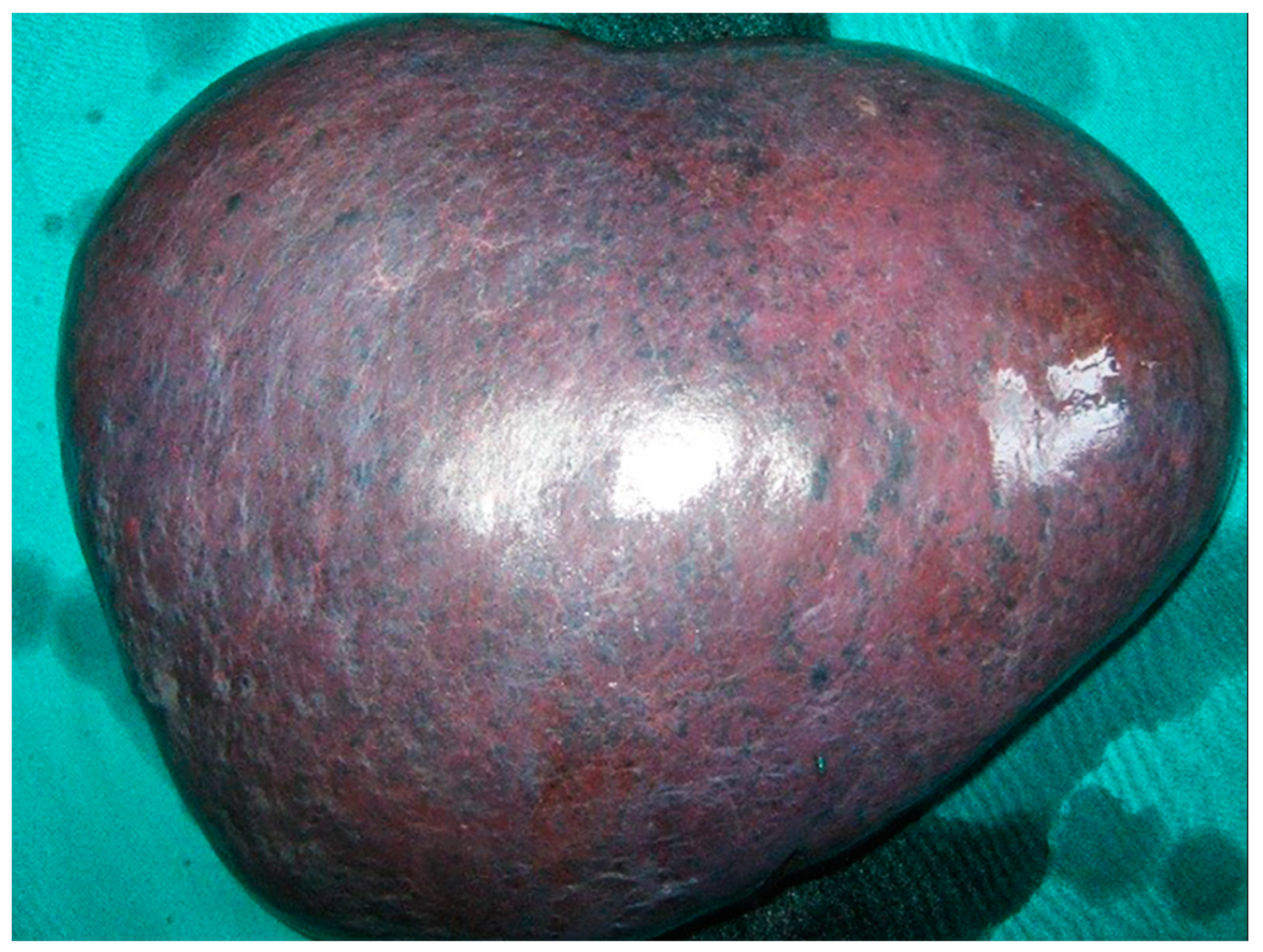 Medicina 58 00184 g003 Medicina 58 00184 g003