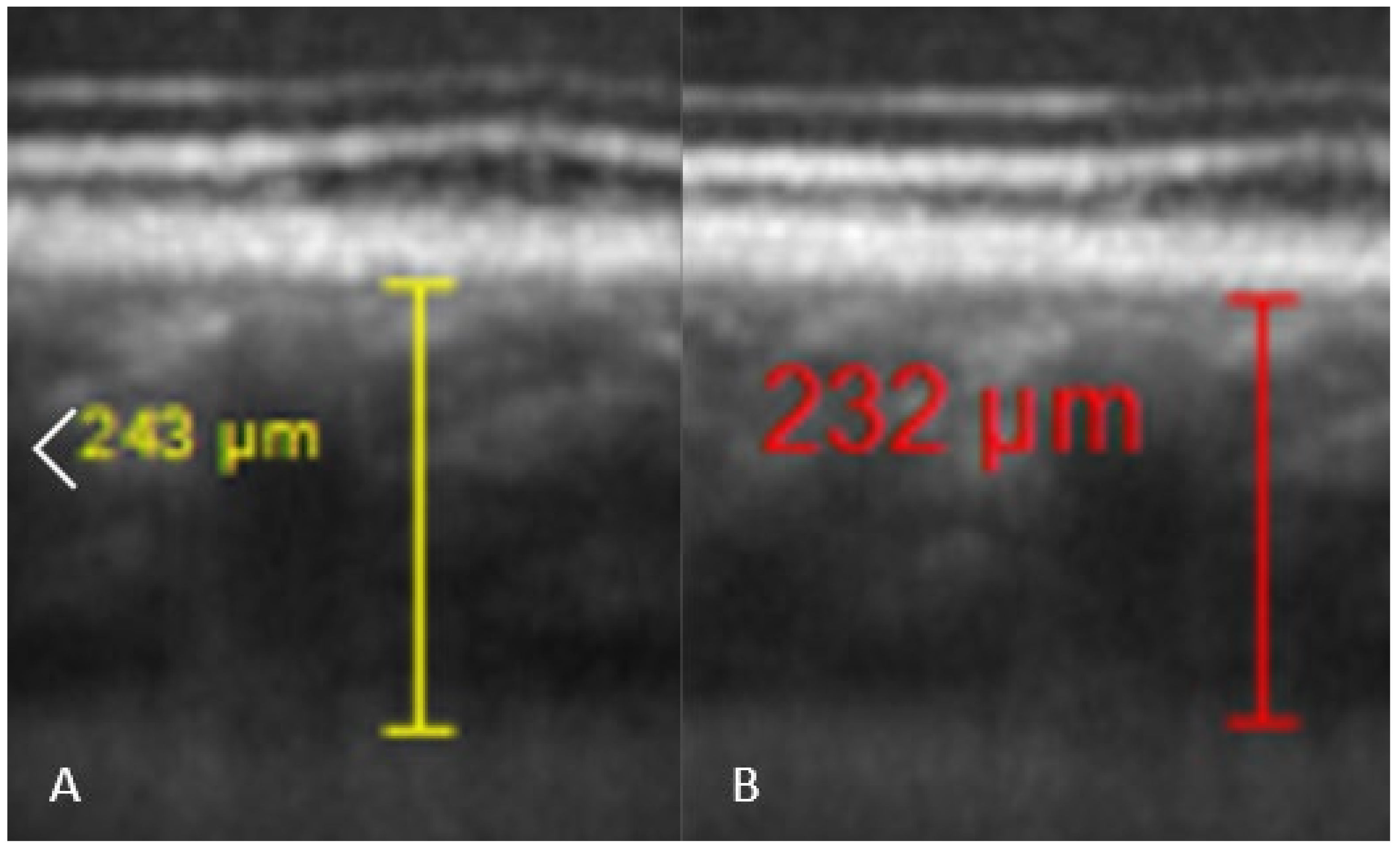 Medicina 58 00408 g004