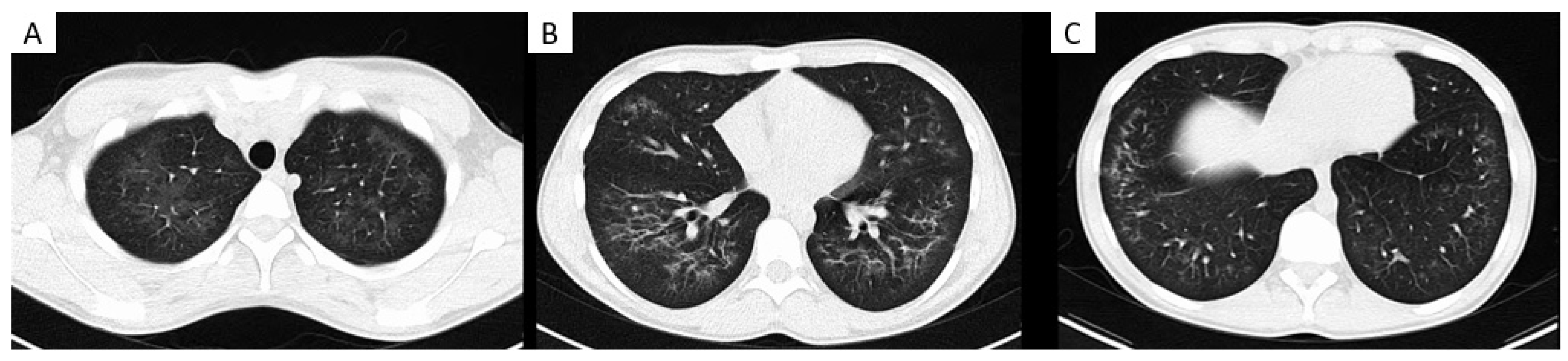 Medicina 58 00412 g002 Medicina 58 00412 g002