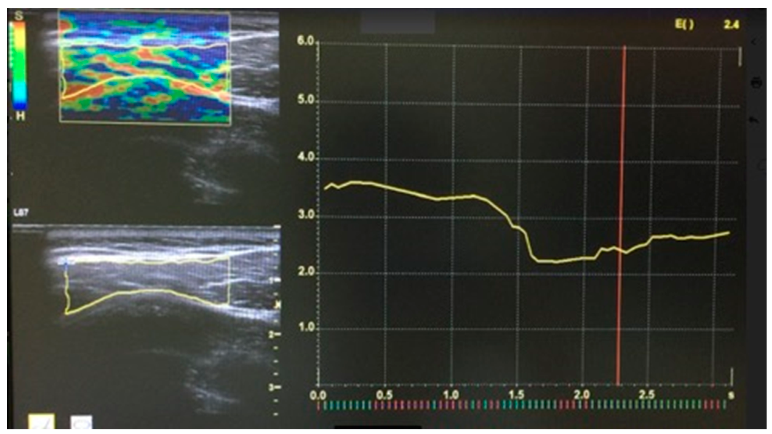 Medicina 58 00479 g002 Medicina 58 00479 g002