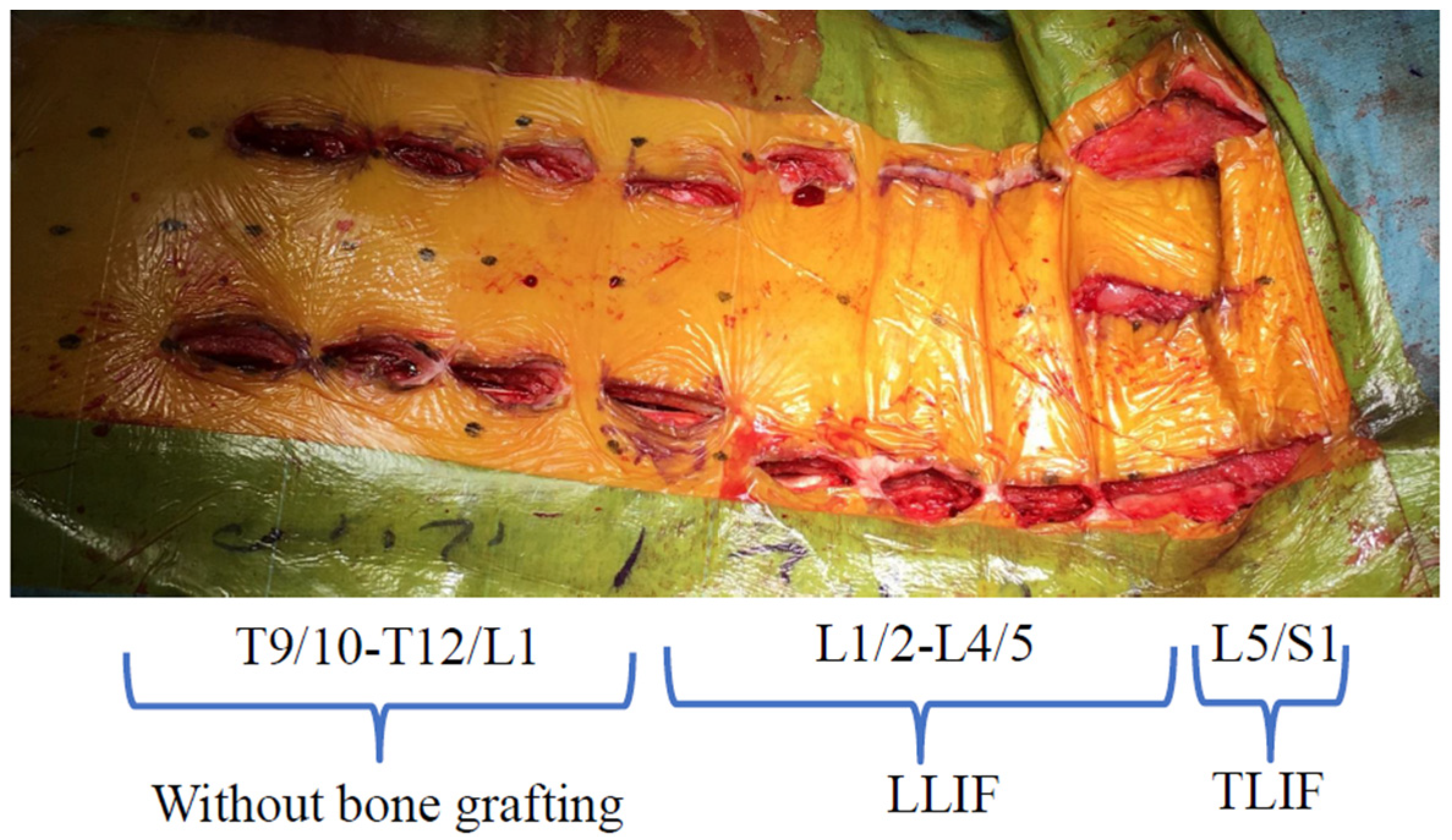 Medicina 58 00496 g003