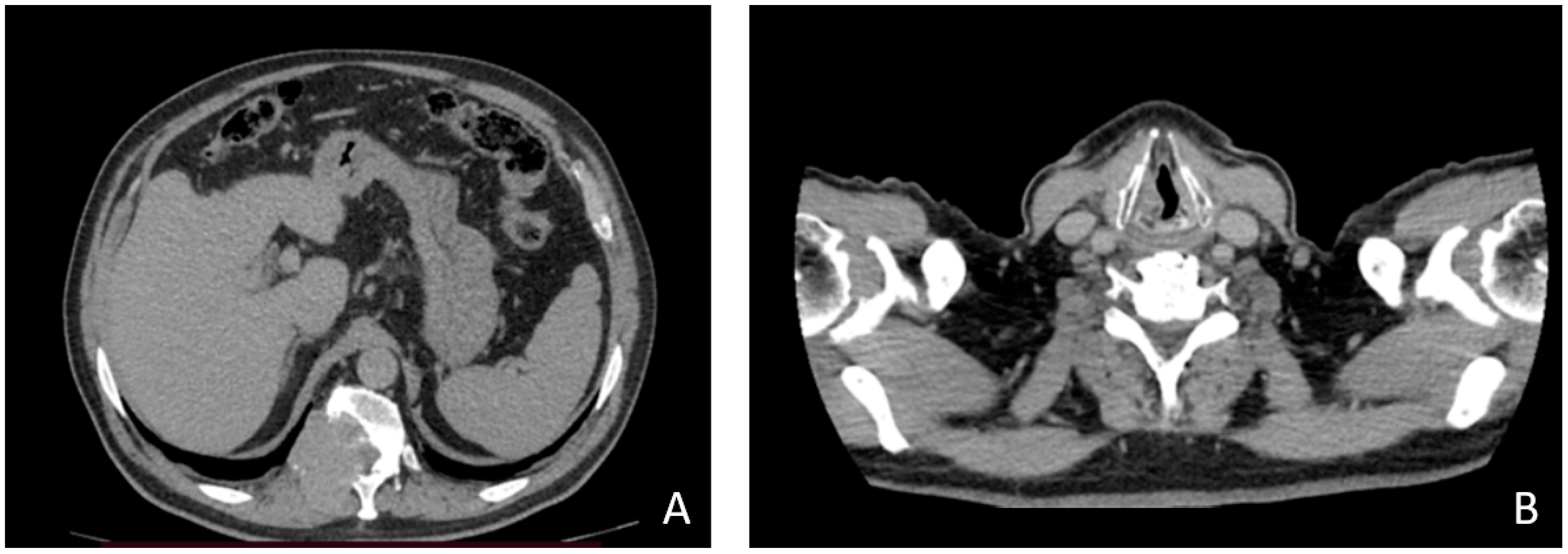 Medicina 58 00666 g002
