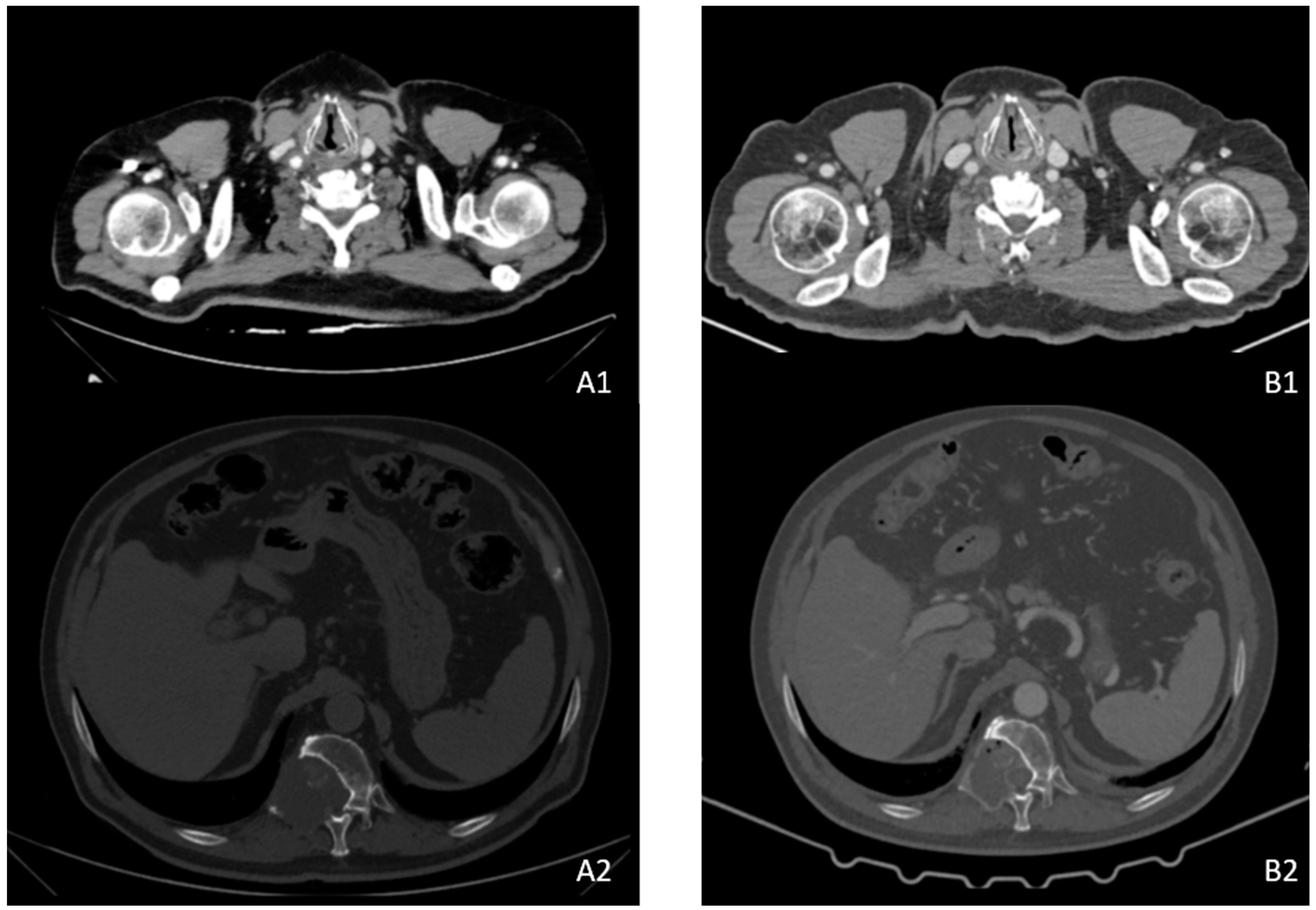 Medicina 58 00666 g004