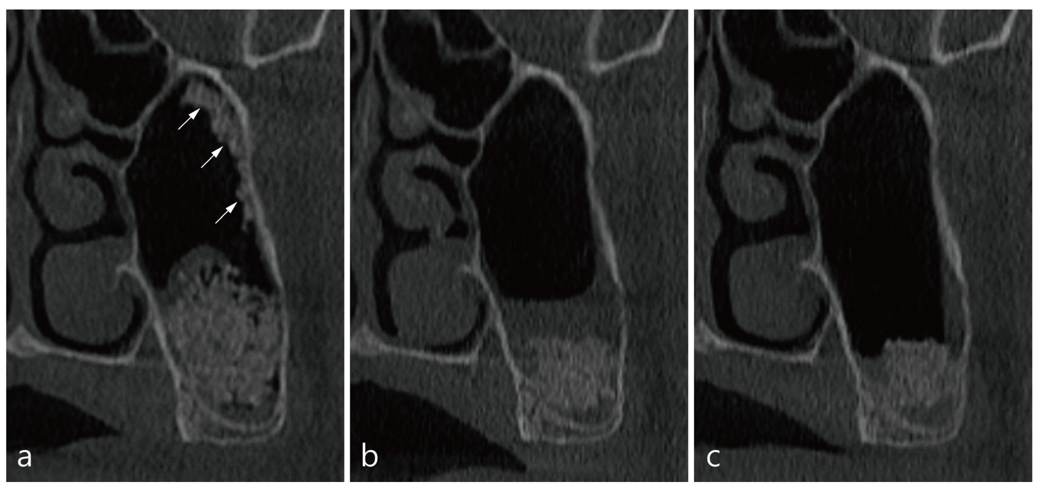 Medicina 58 00672 g003