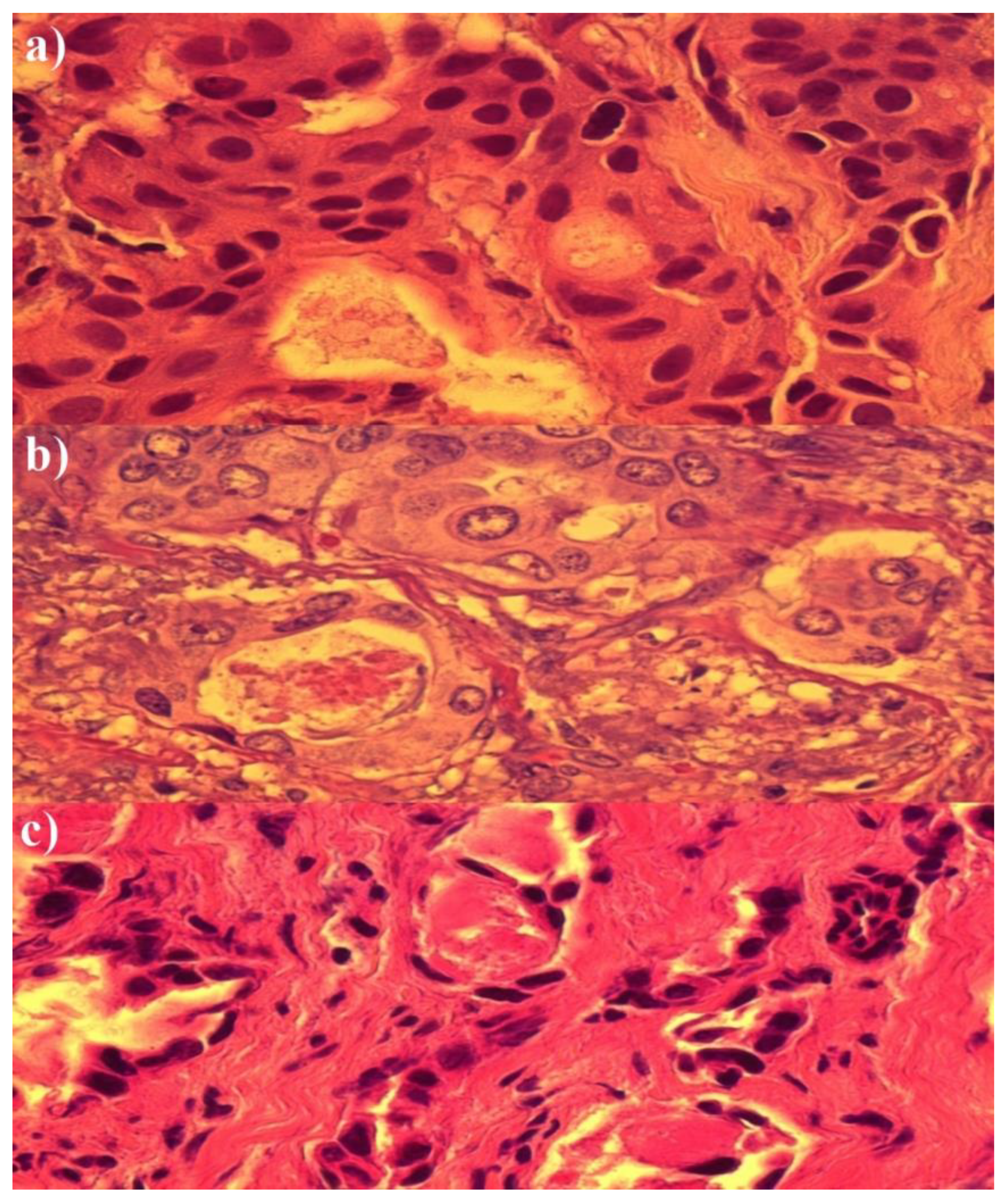 Medicina 58 00700 g002
