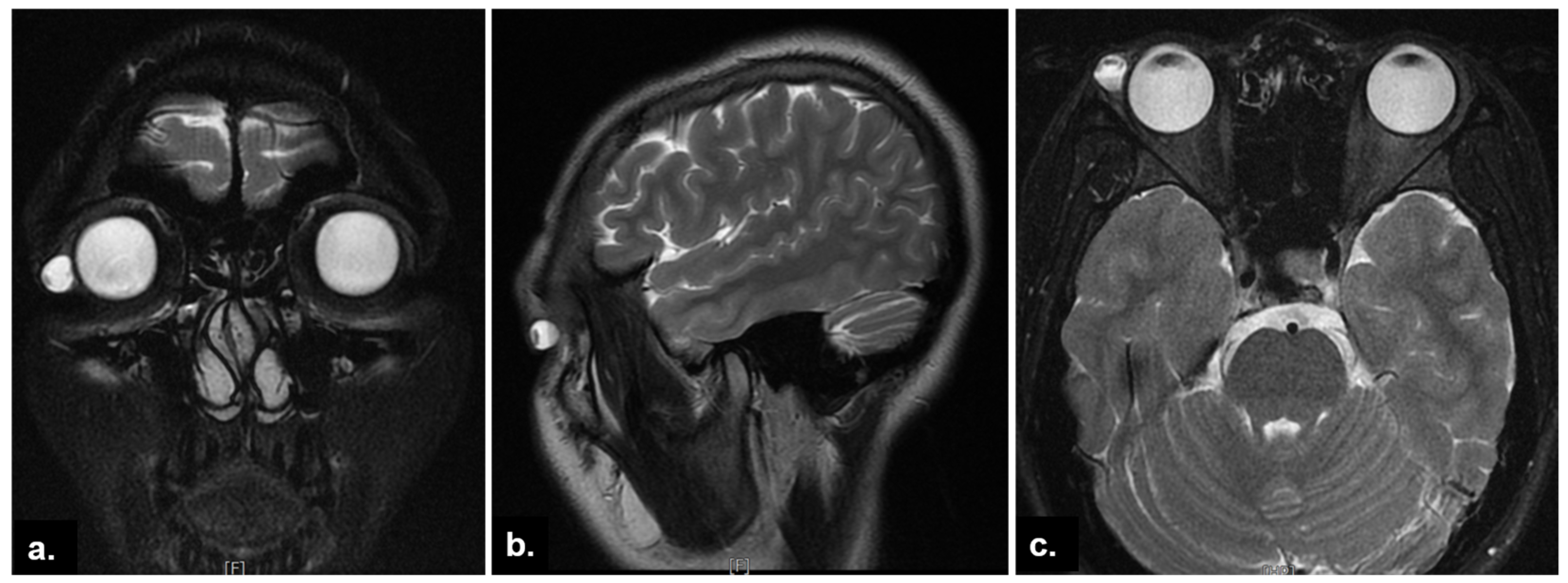 Medicina 58 00840 g002