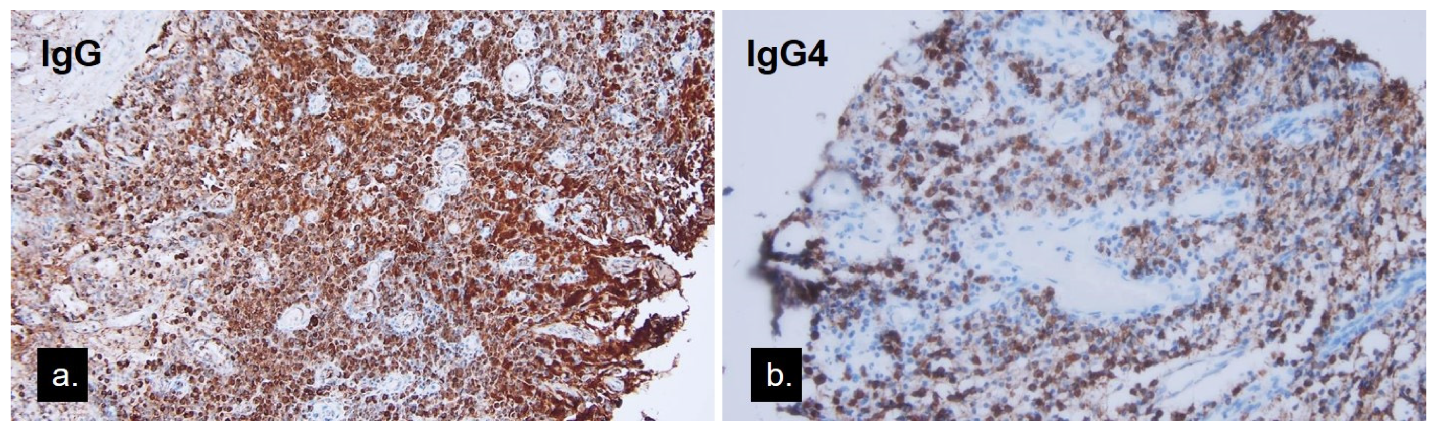 Medicina 58 00840 g005