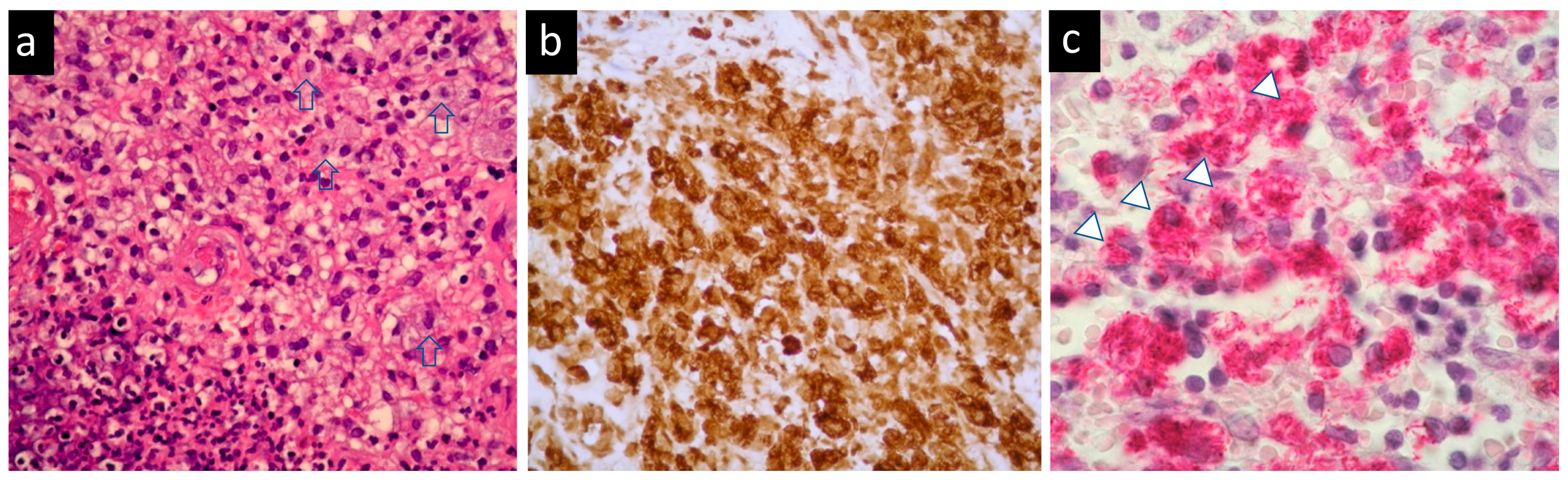 Medicina 58 00846 g003