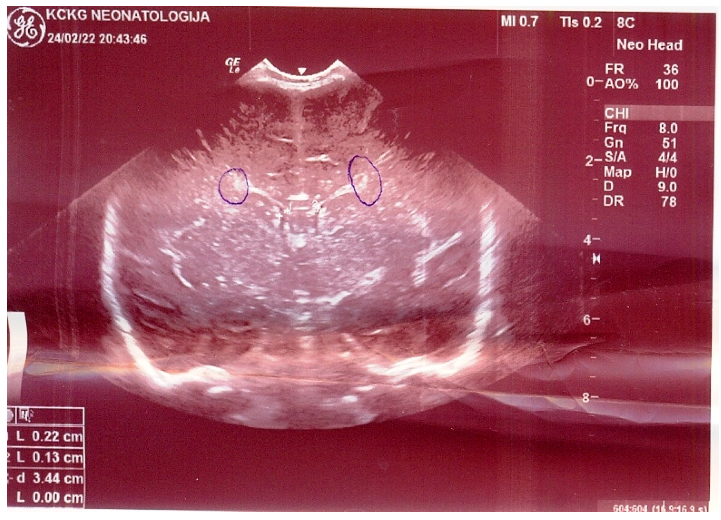 Medicina 58 01150 g002 Medicina 58 01150 g002