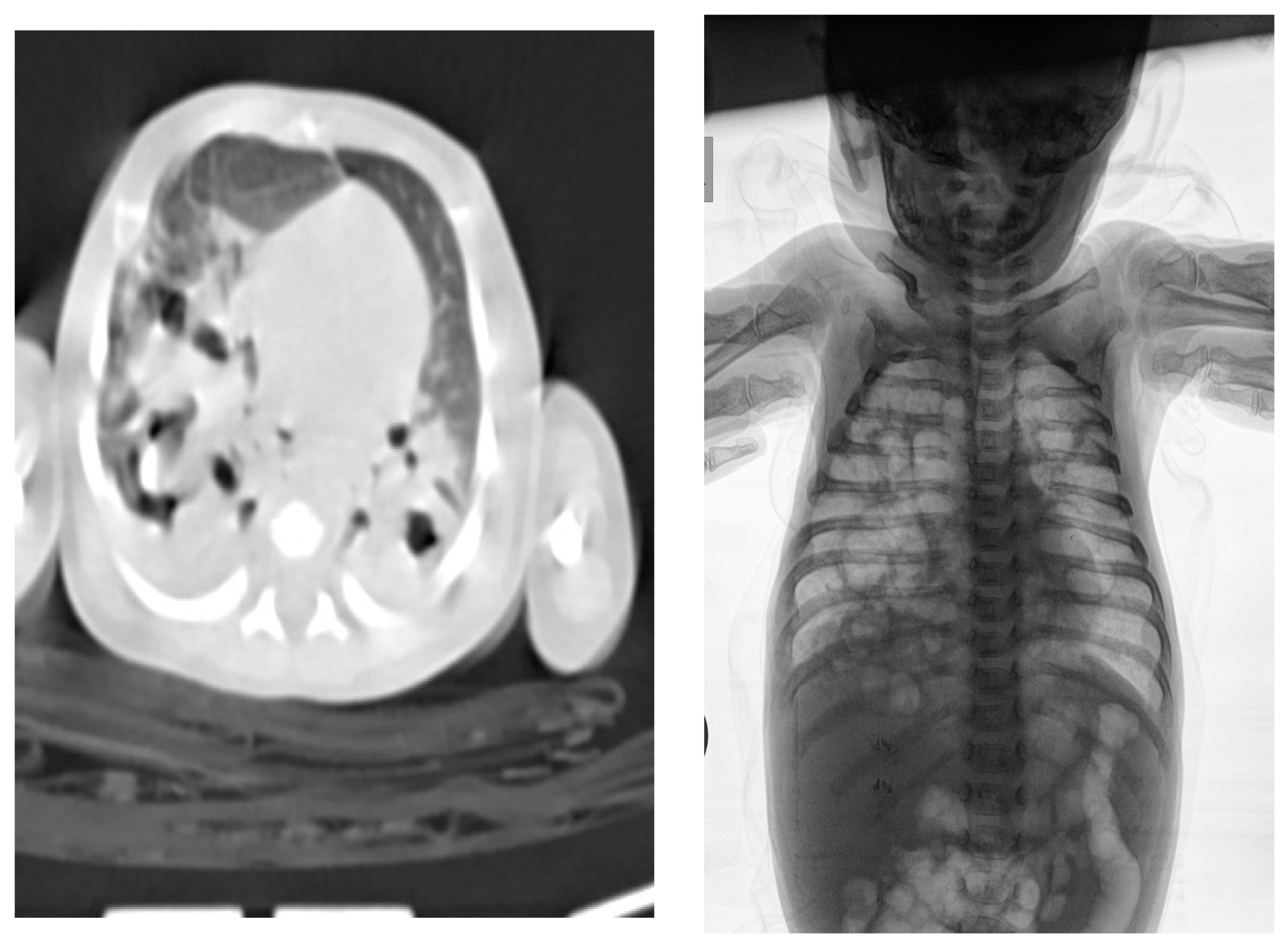 Medicina 58 01150 g003 Medicina 58 01150 g003