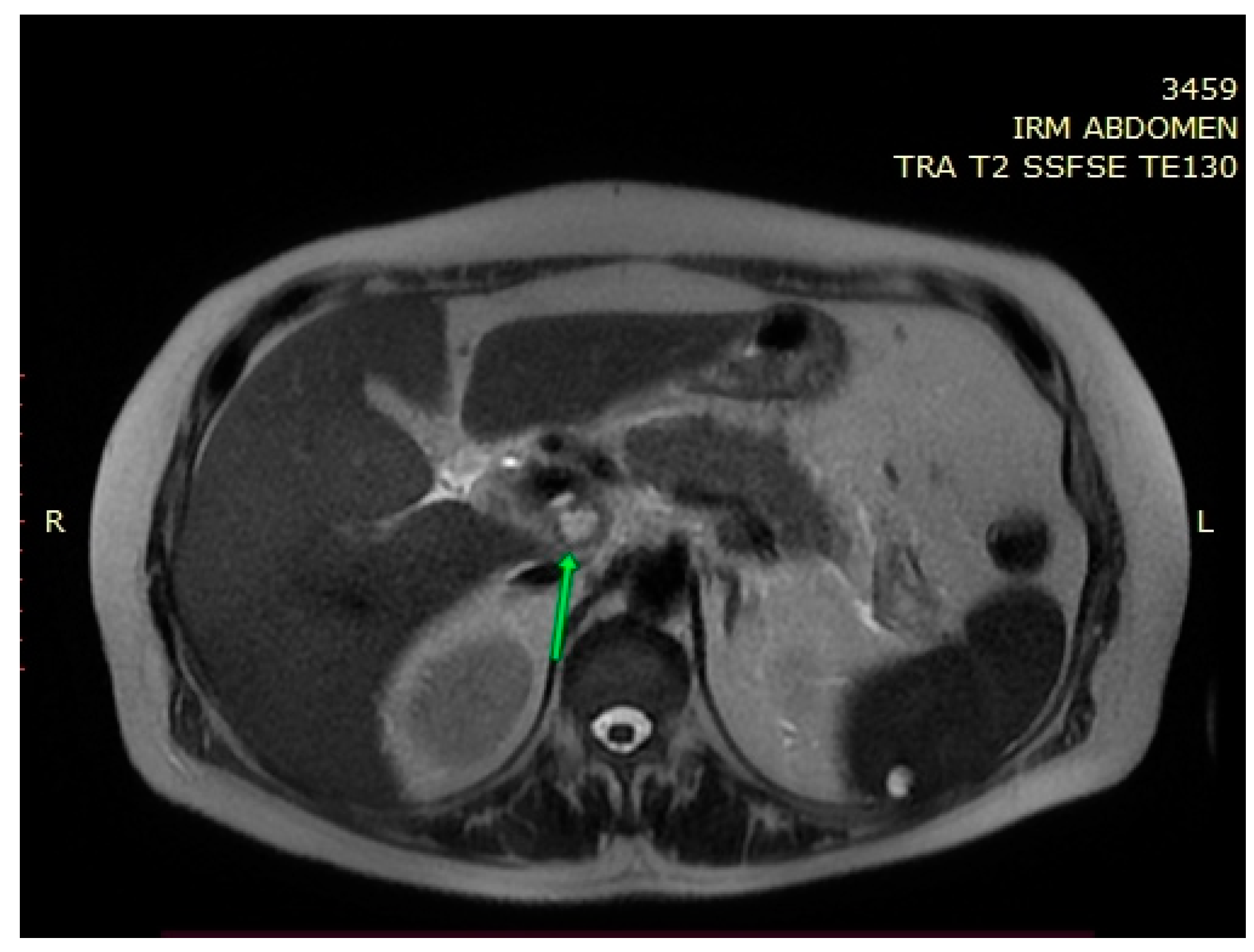 Medicina 58 01165 g002 Medicina 58 01165 g002