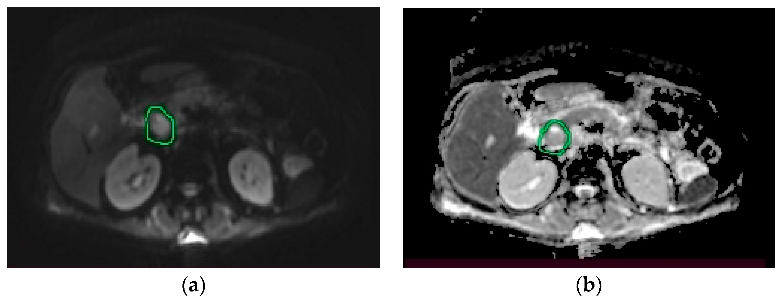 Medicina 58 01165 g004 Medicina 58 01165 g004