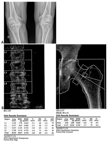 https://www.mdpi.com/medicina/medicina-58-01207/article_deploy/html/images/medicina-58-01207-g003-550.jpg