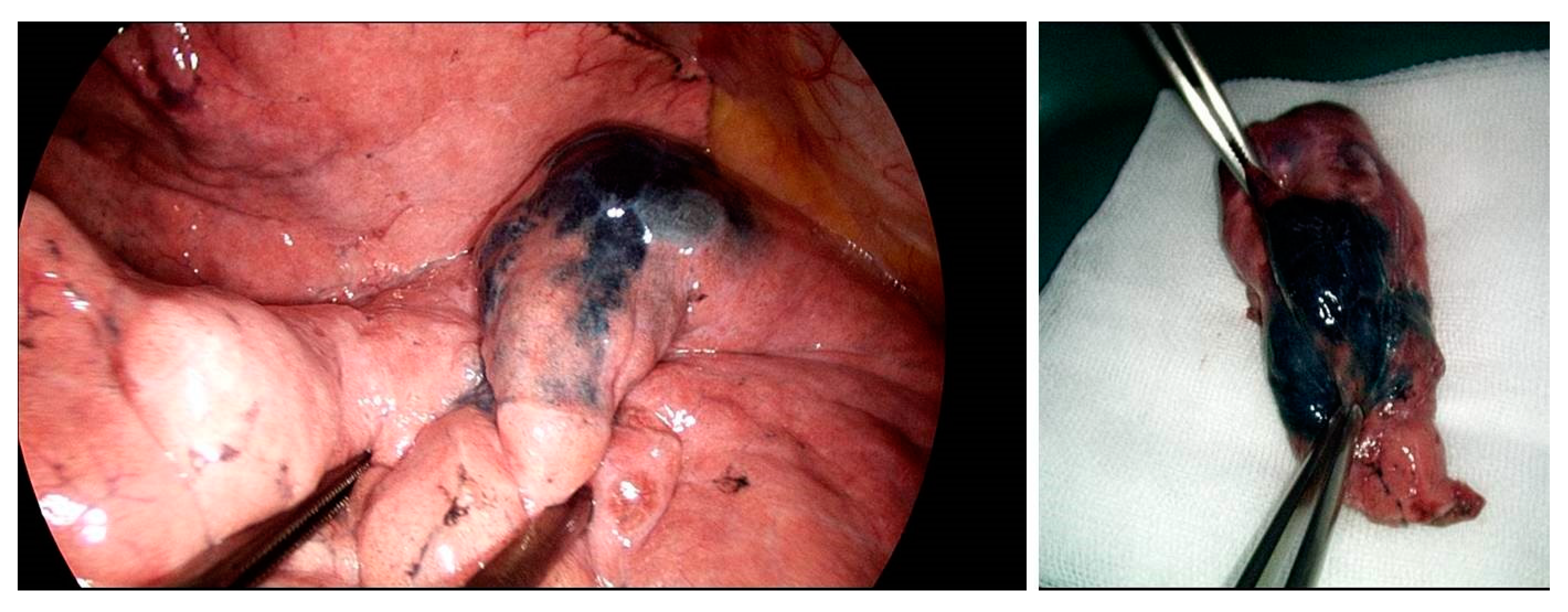 Medicina 58 01235 g002