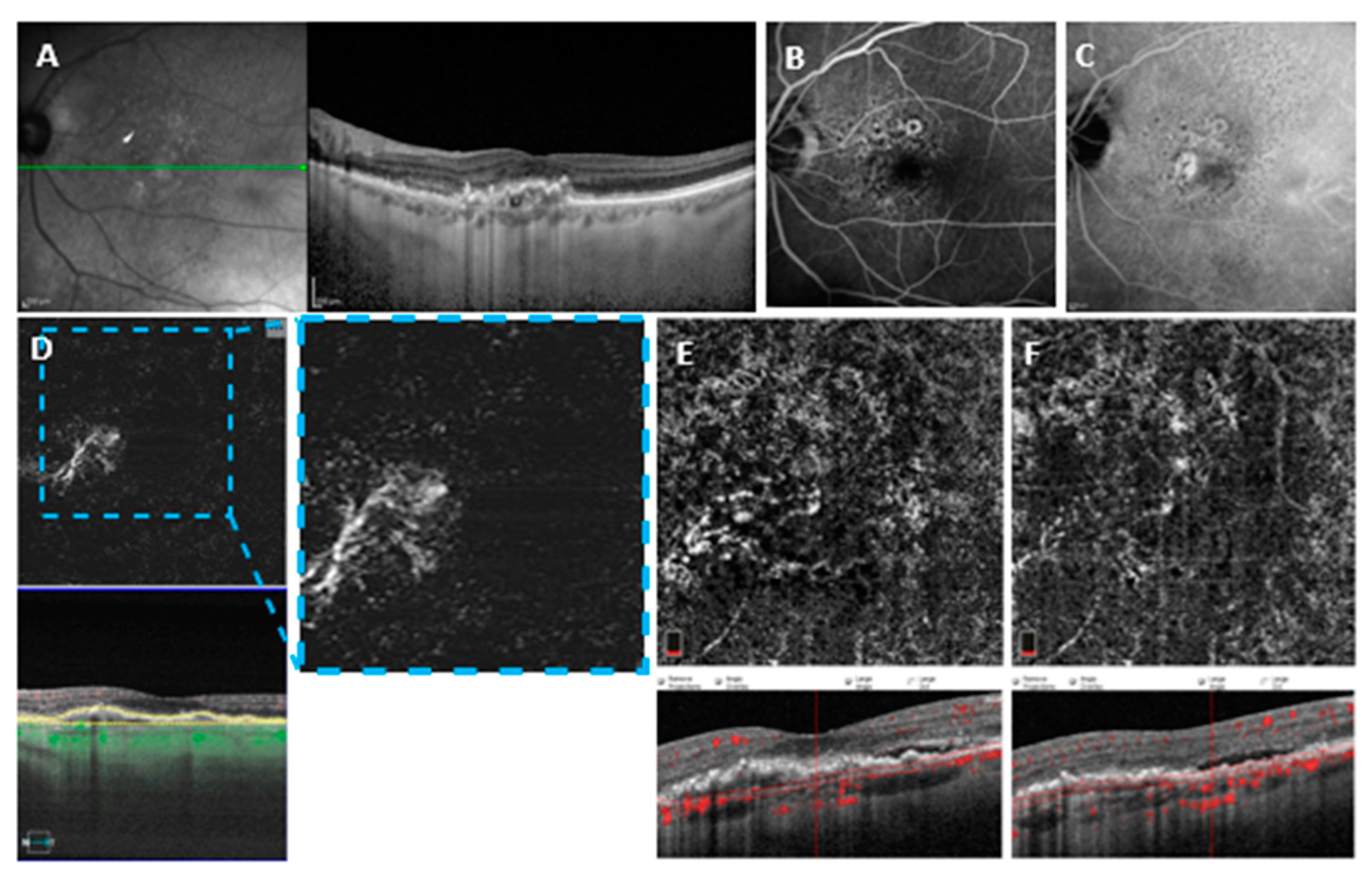 Medicina 58 01246 g003