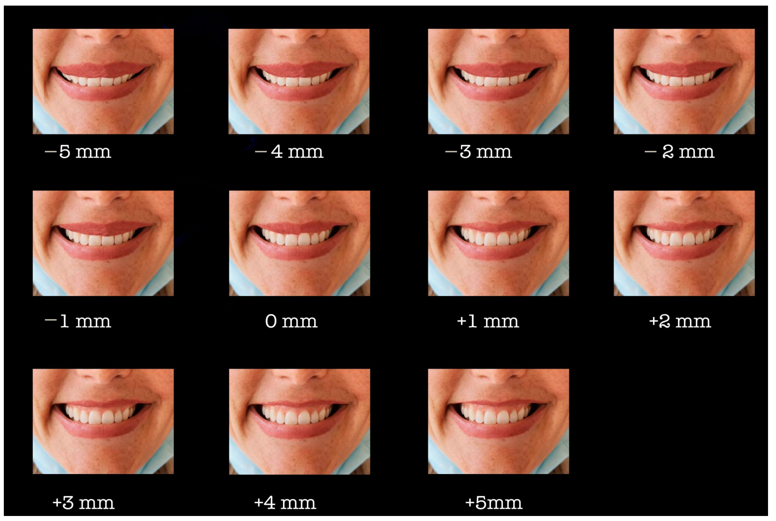 Details 83+ sketch of smiling lips best - seven.edu.vn