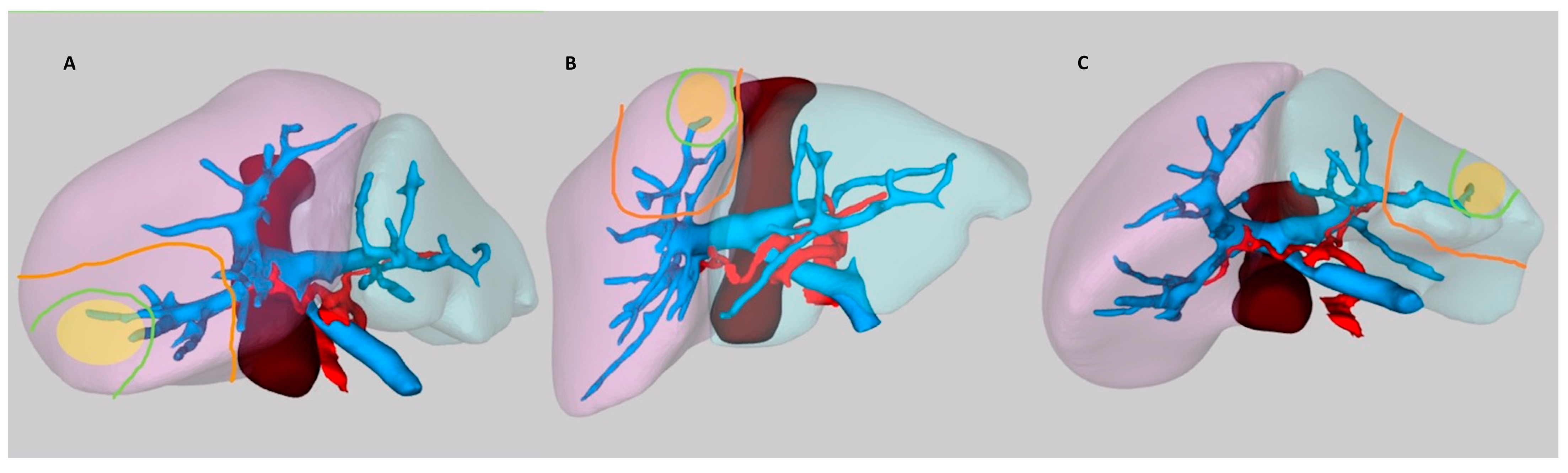 Nar - HB Radiofrequency