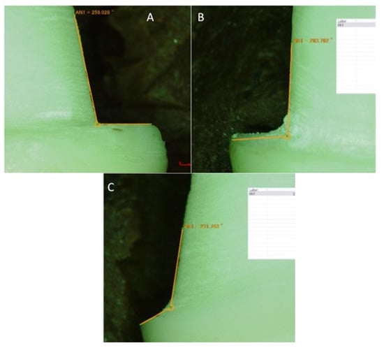 Medicina | Free Full-Text | Marginal Misfit of 3D-Printed