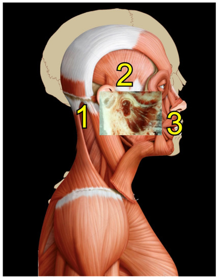 11.5 Axial muscles of the abdominal wall and thorax – Anatomy