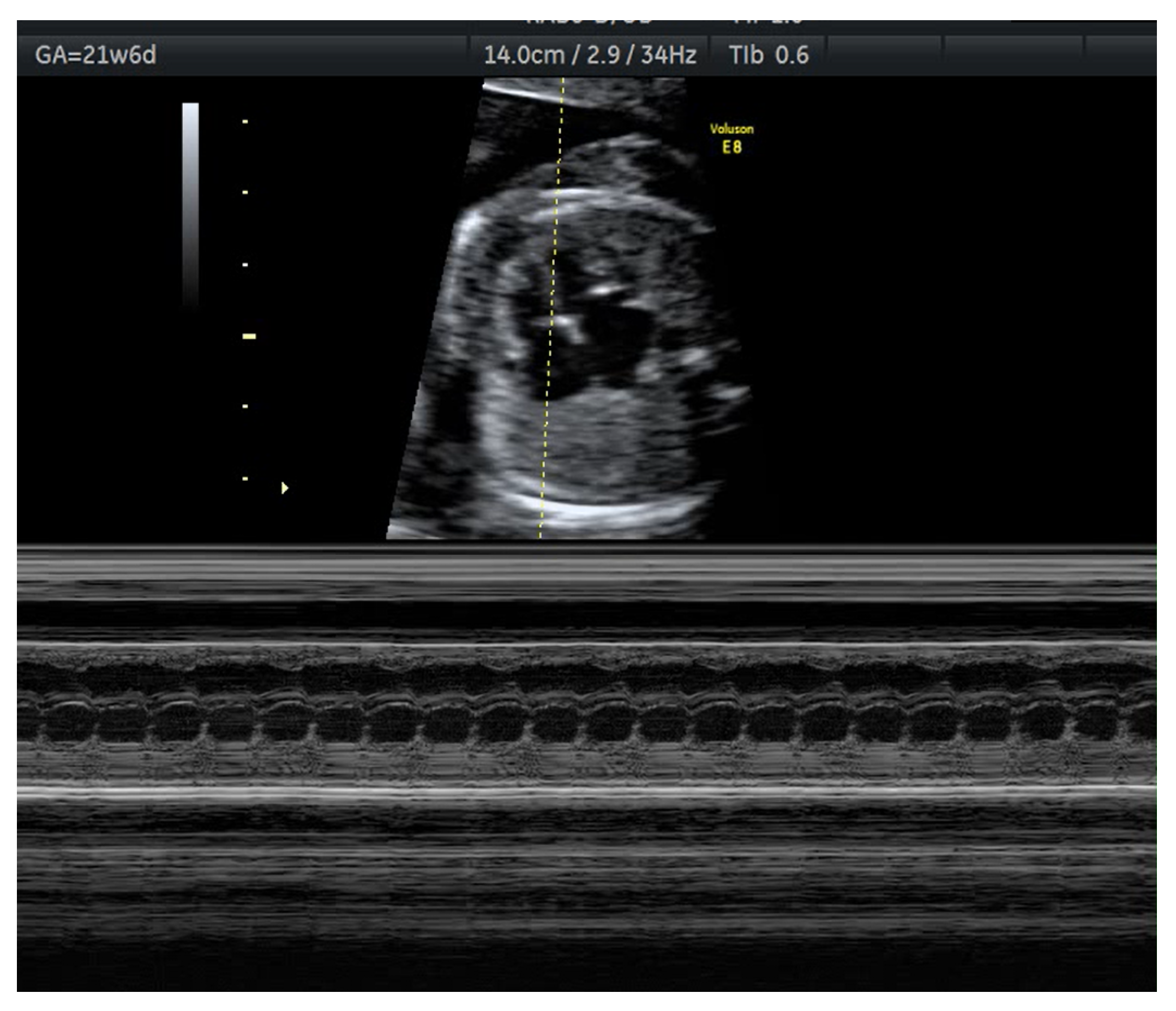 Pre-pregnancy aspects relevant for patients with known systemic