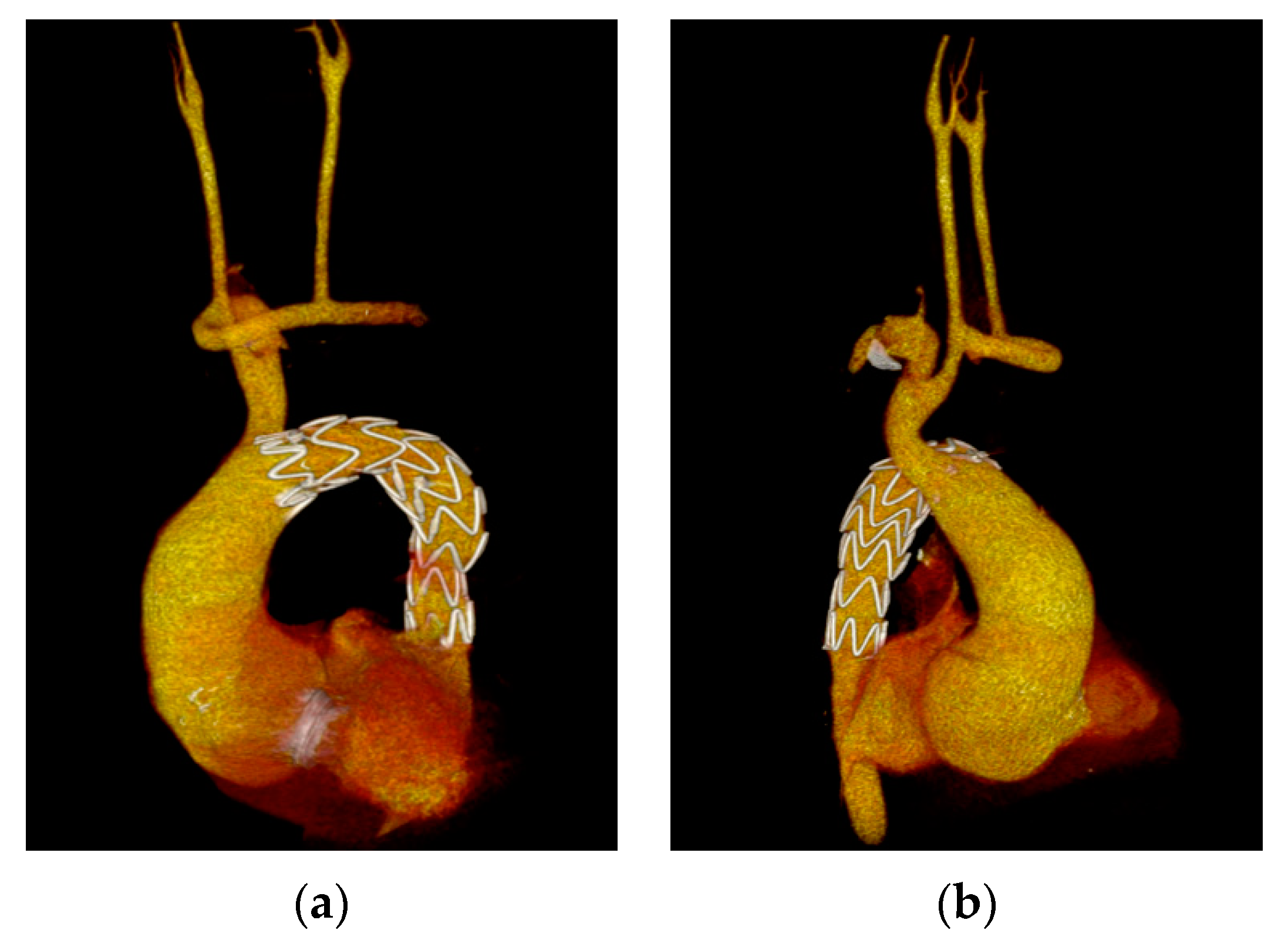 Medicina 58 01385 g002 Medicina 58 01385 g002