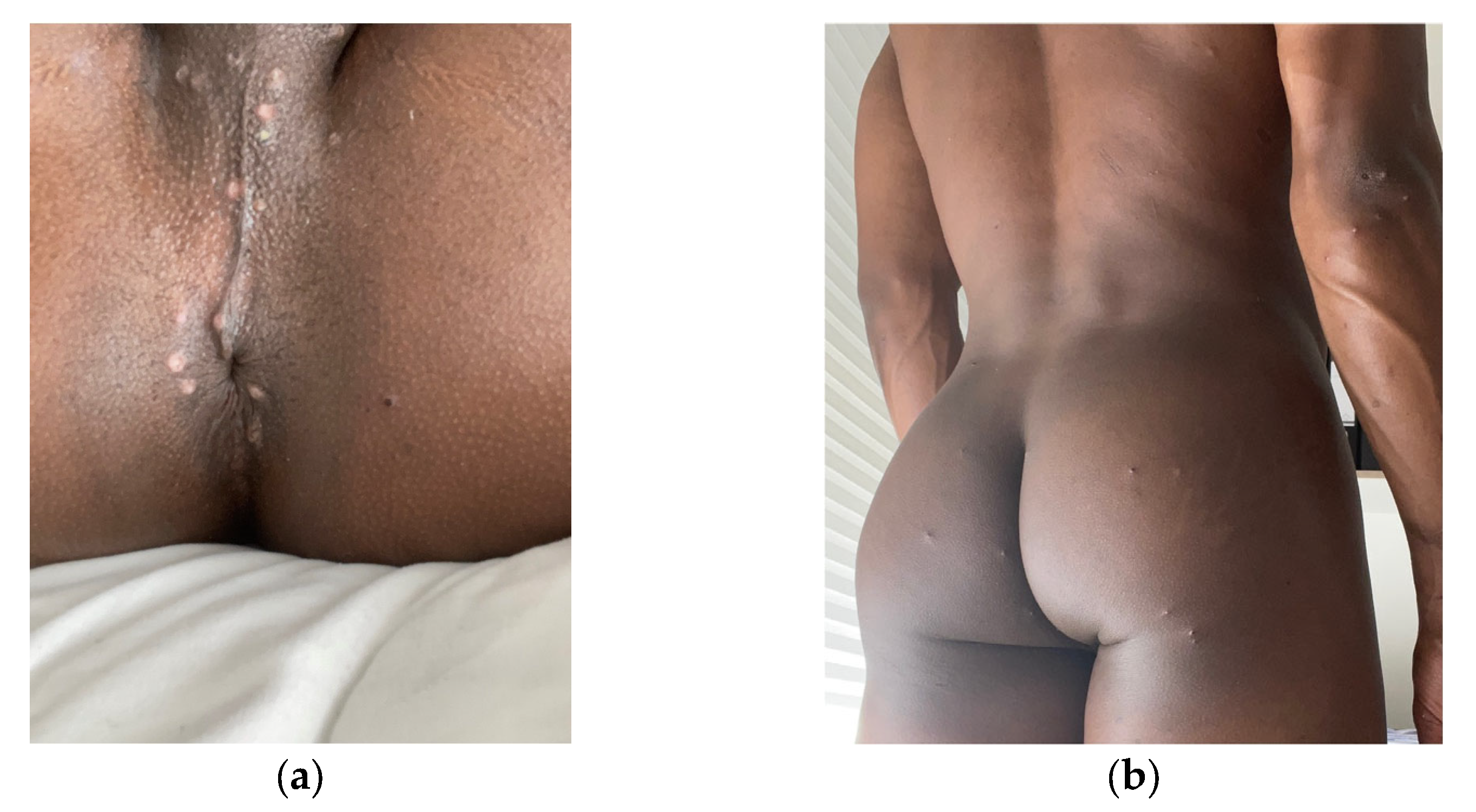 Medicina 58 01409 g001 Medicina 58 01409 g001