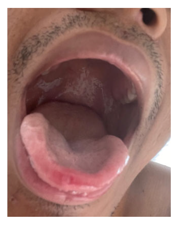 Medicina 58 01409 g002 Medicina 58 01409 g002