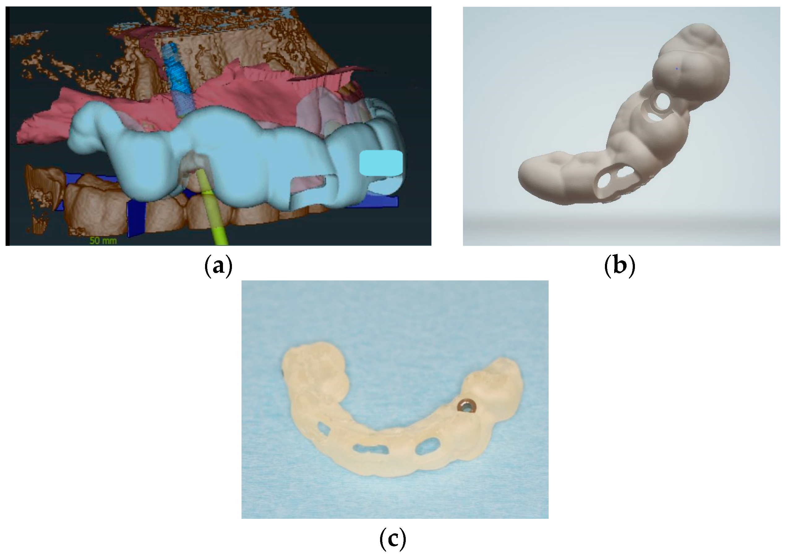 Medicina 58 01612 g004 Medicina 58 01612 g004