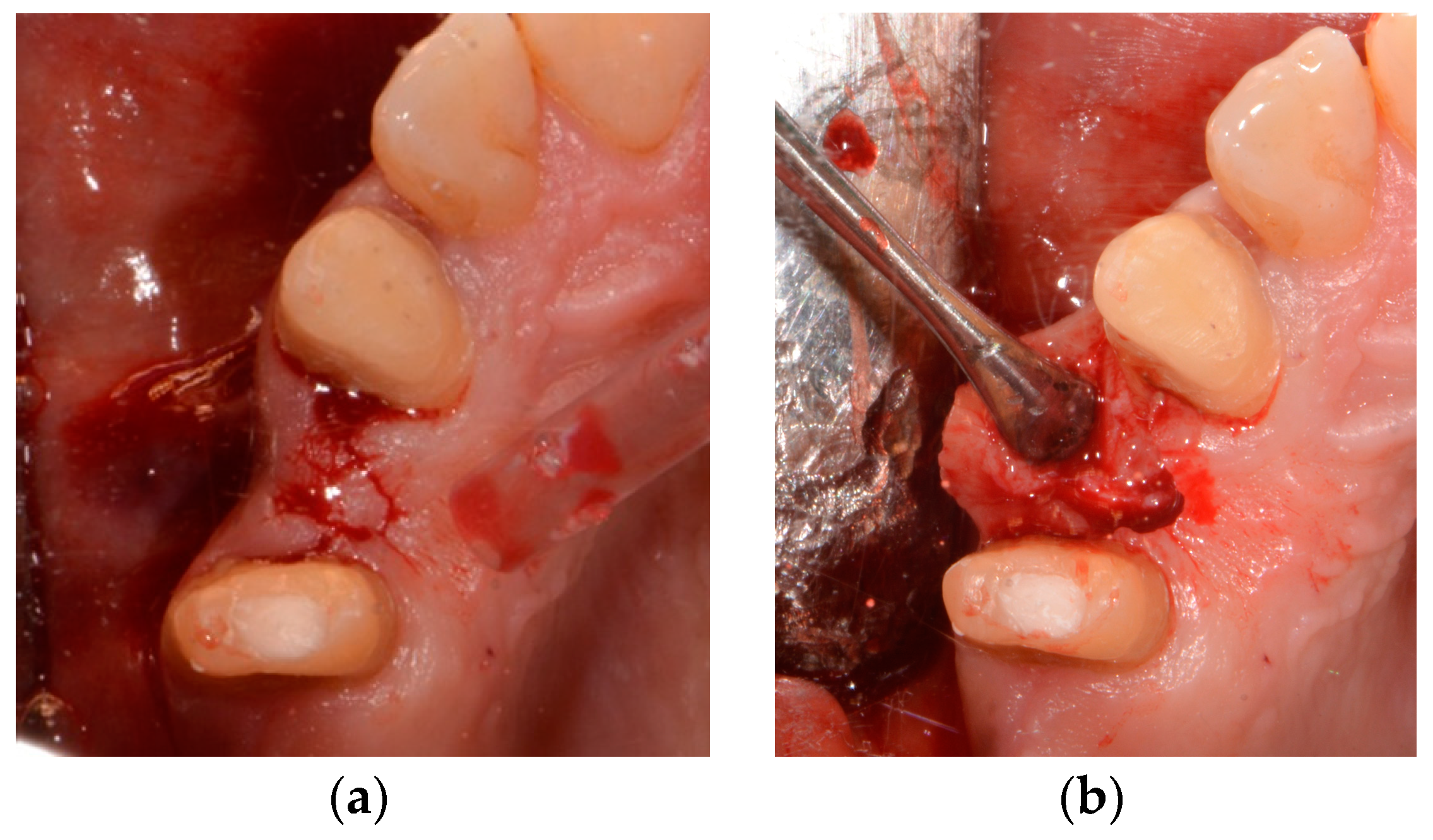 Medicina 58 01612 g005 Medicina 58 01612 g005