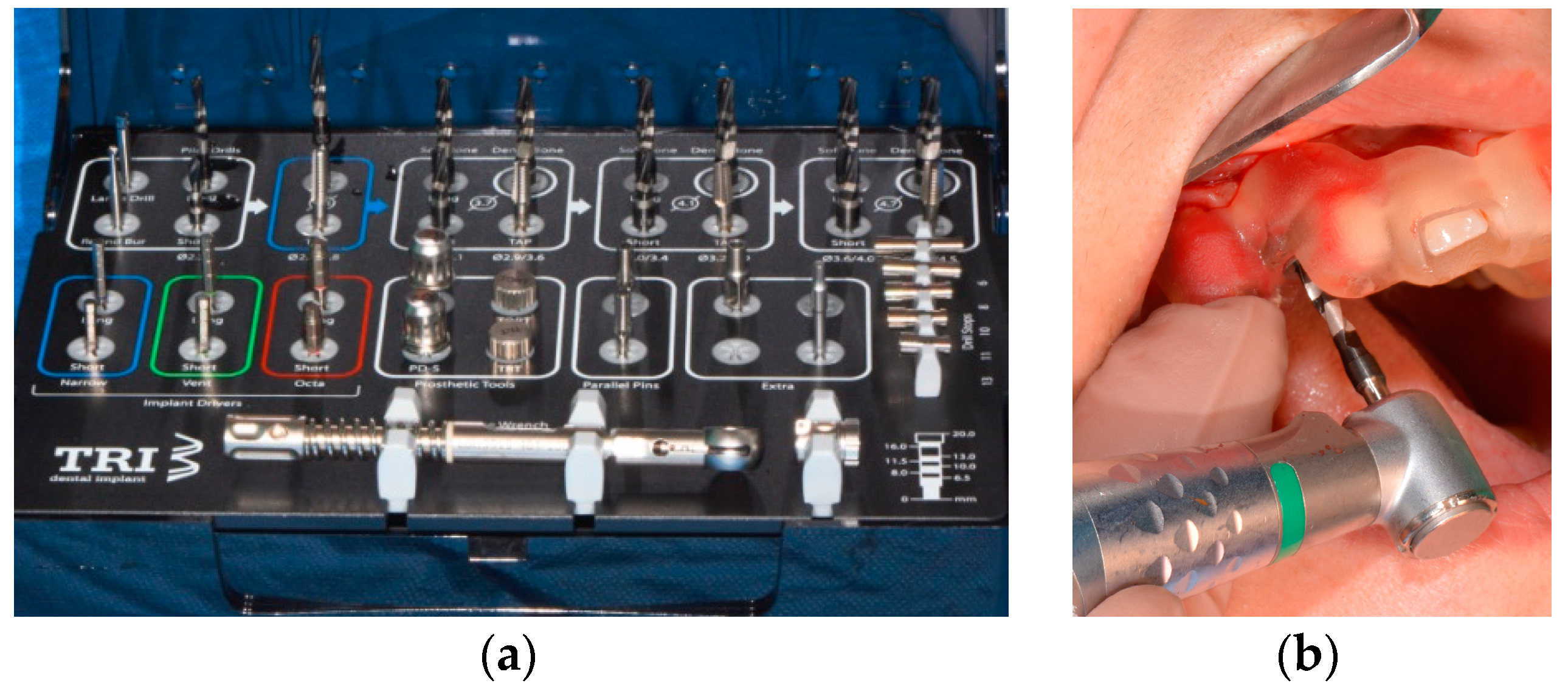 Medicina 58 01612 g006 Medicina 58 01612 g006