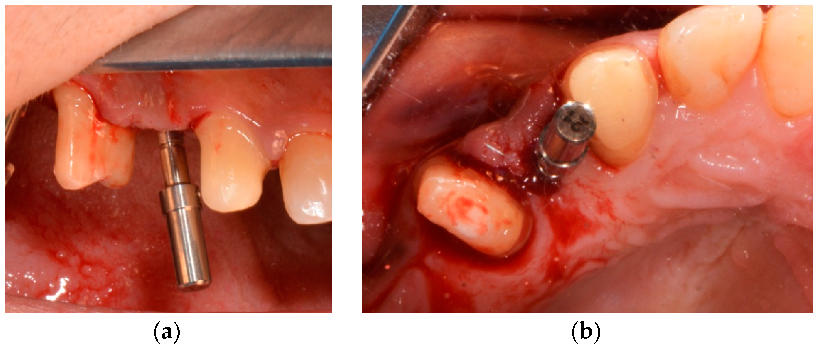 Medicina 58 01612 g007 Medicina 58 01612 g007