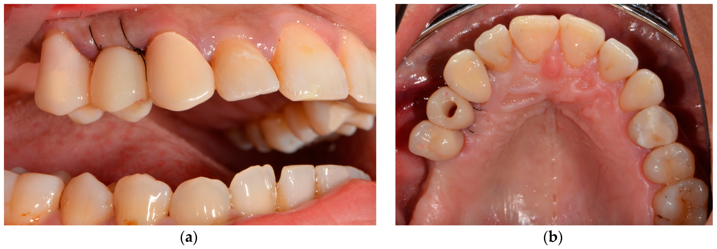 Medicina 58 01612 g013 Medicina 58 01612 g013