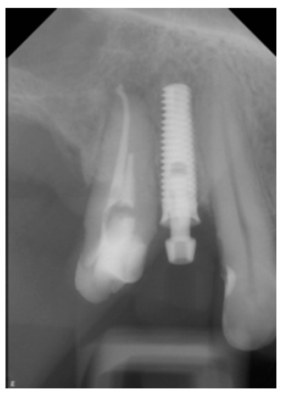 Medicina 58 01612 g014 Medicina 58 01612 g014