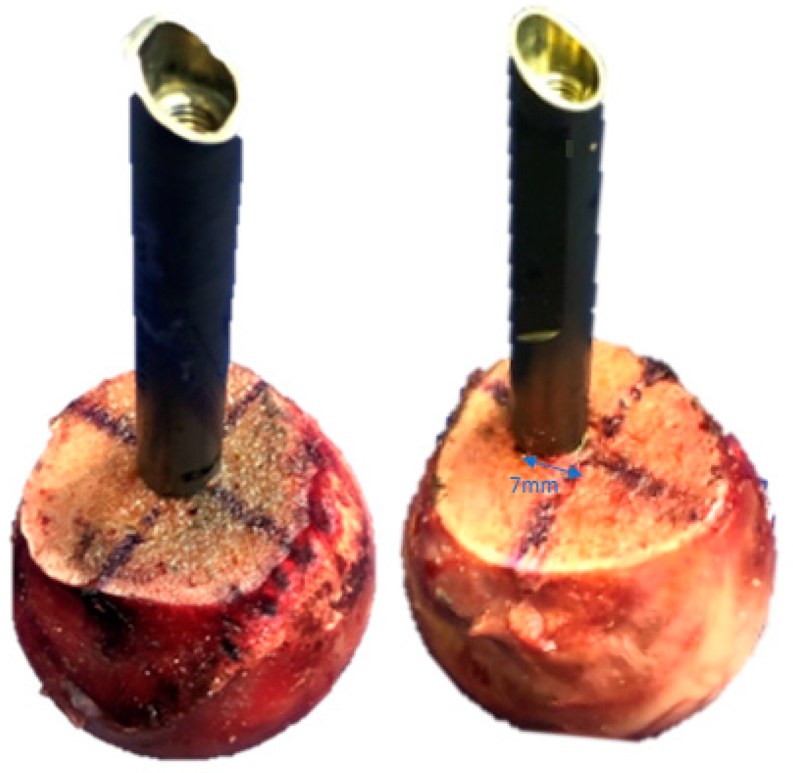 Medicina 58 01636 g001 Medicina 58 01636 g001