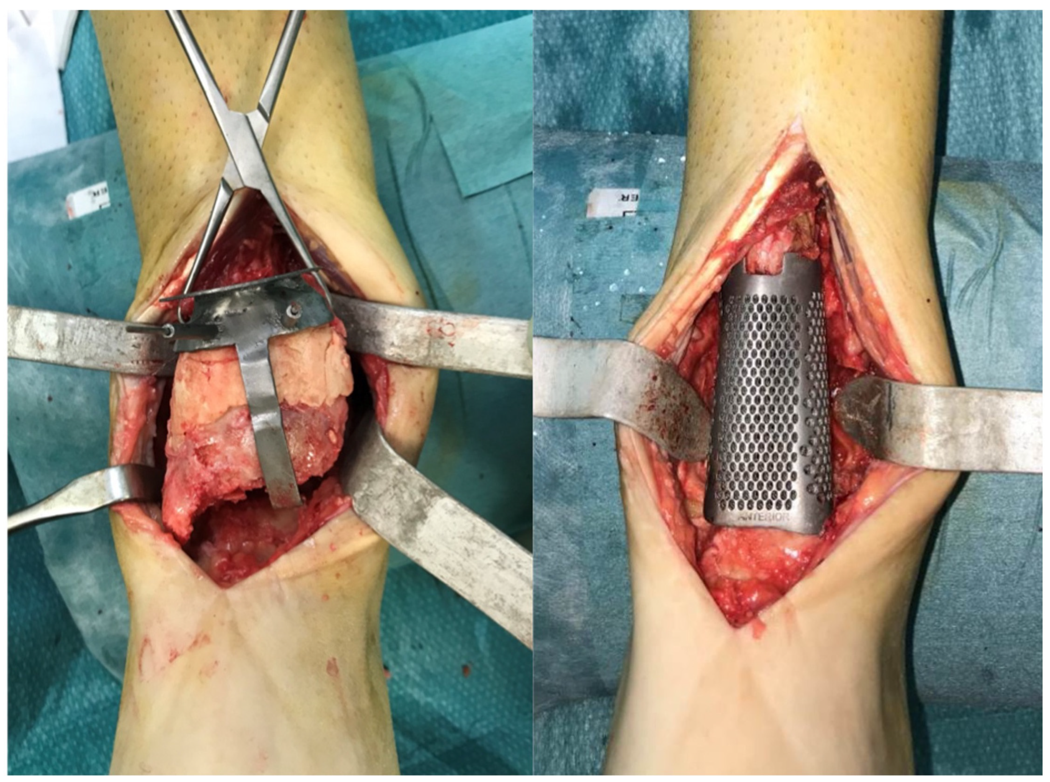 Medicina 58 01641 g003