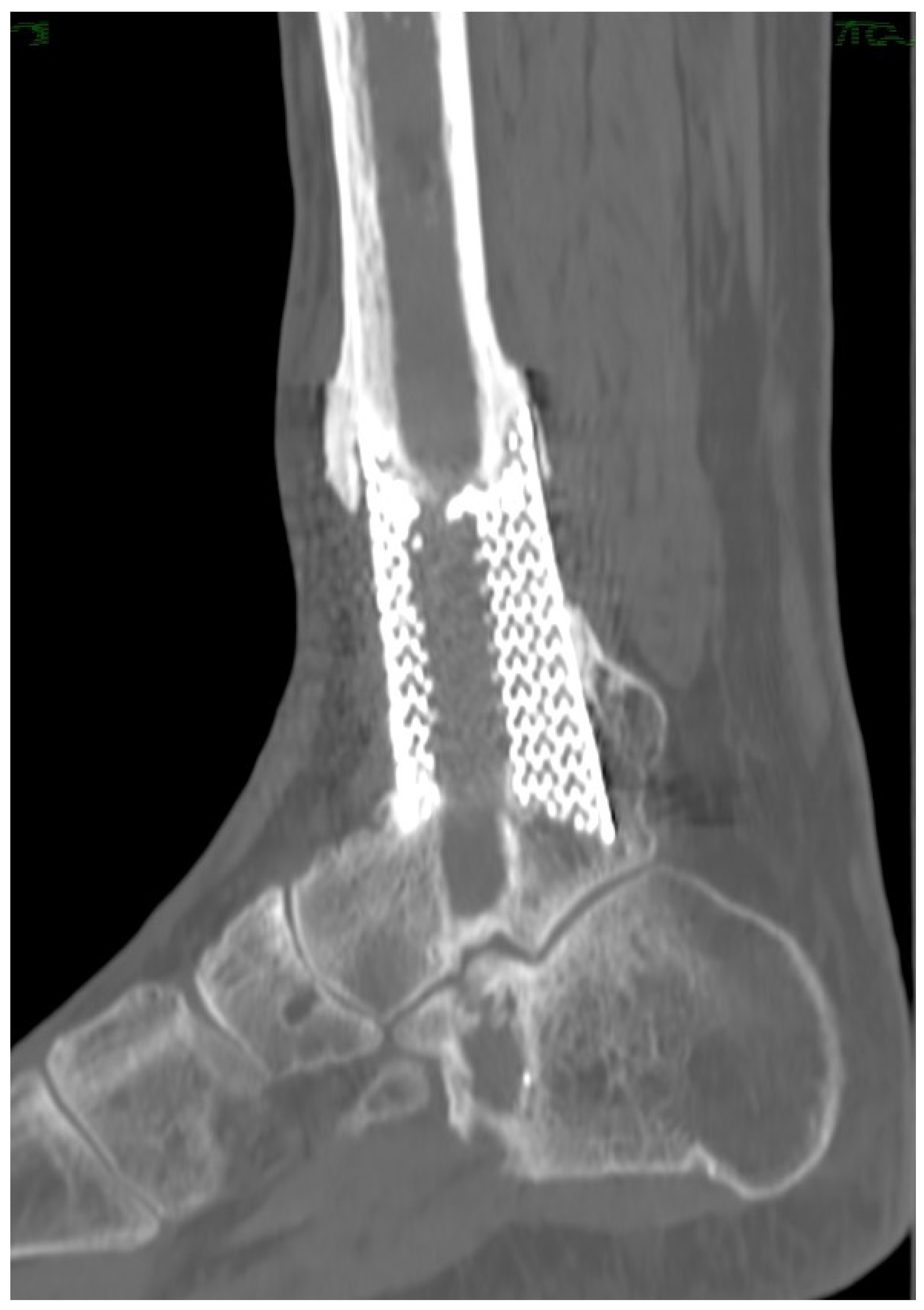 Medicina 58 01641 g005