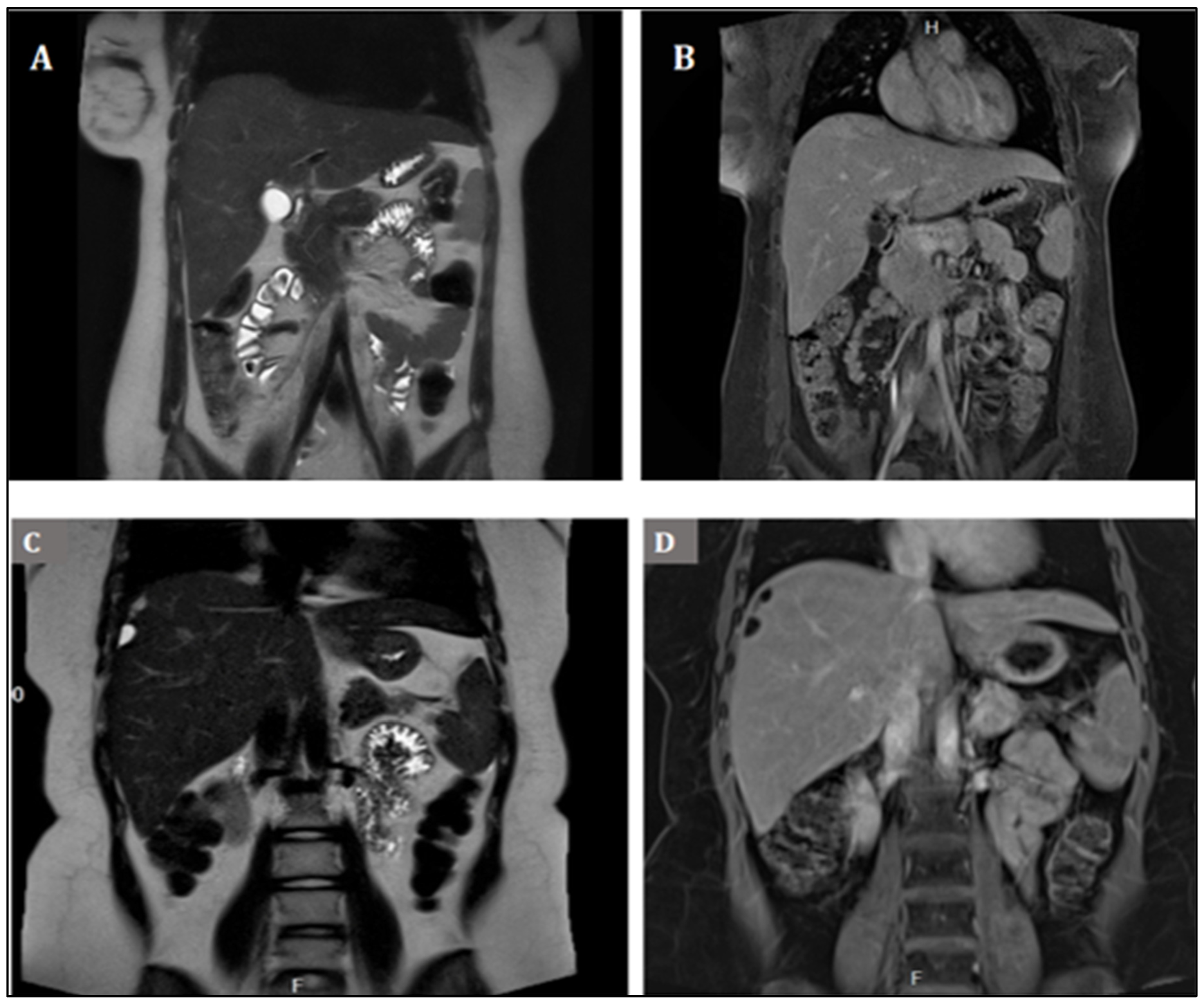 Medicina 58 01715 g003 Medicina 58 01715 g003