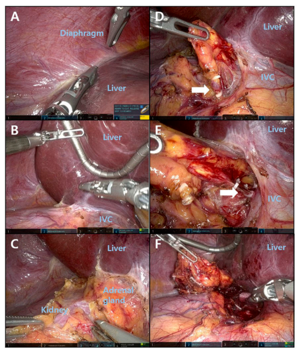 Medicina 58 01747 g002 Medicina 58 01747 g002