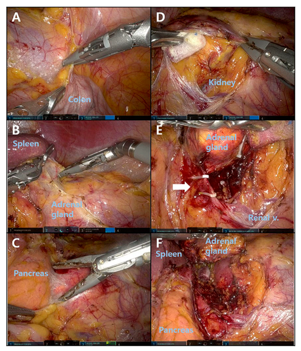 Medicina 58 01747 g003 Medicina 58 01747 g003