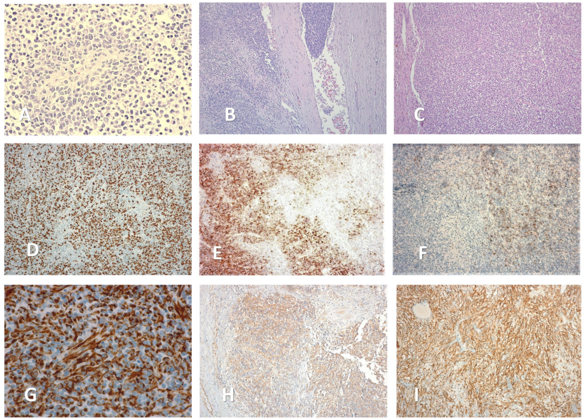 Medicina 59 00033 g004 Medicina 59 00033 g004