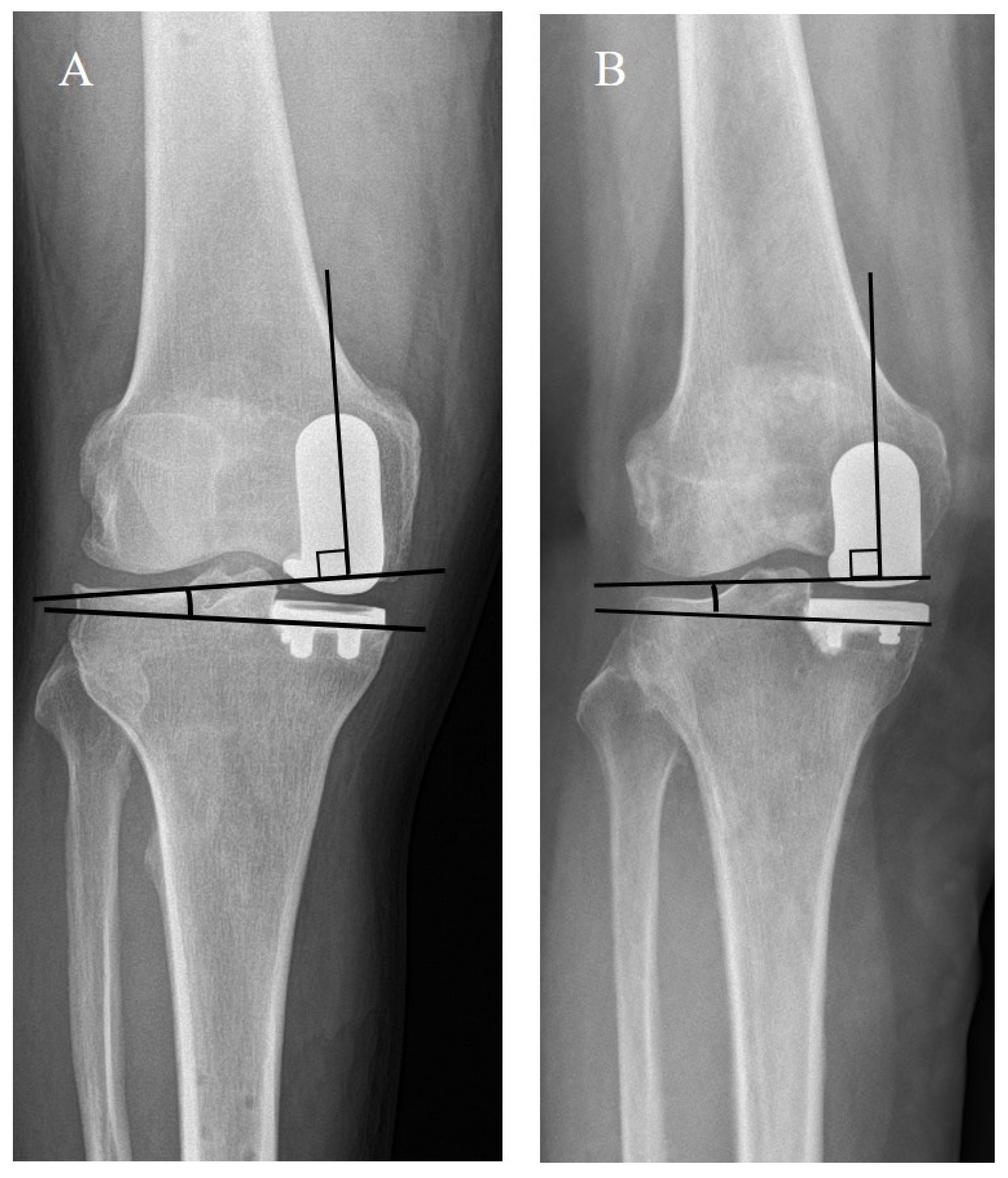Medicina 59 00089 g004 Medicina 59 00089 g004