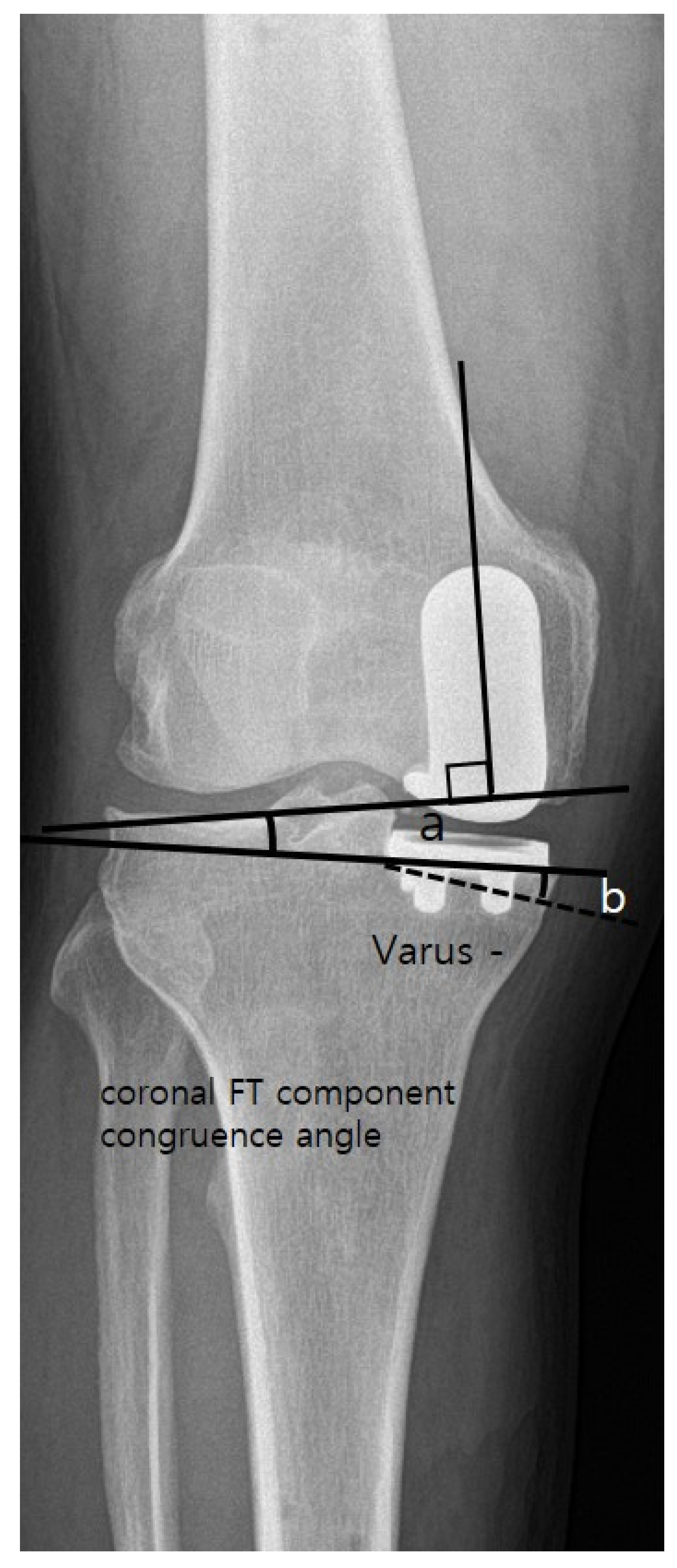 Medicina 59 00089 g005 Medicina 59 00089 g005