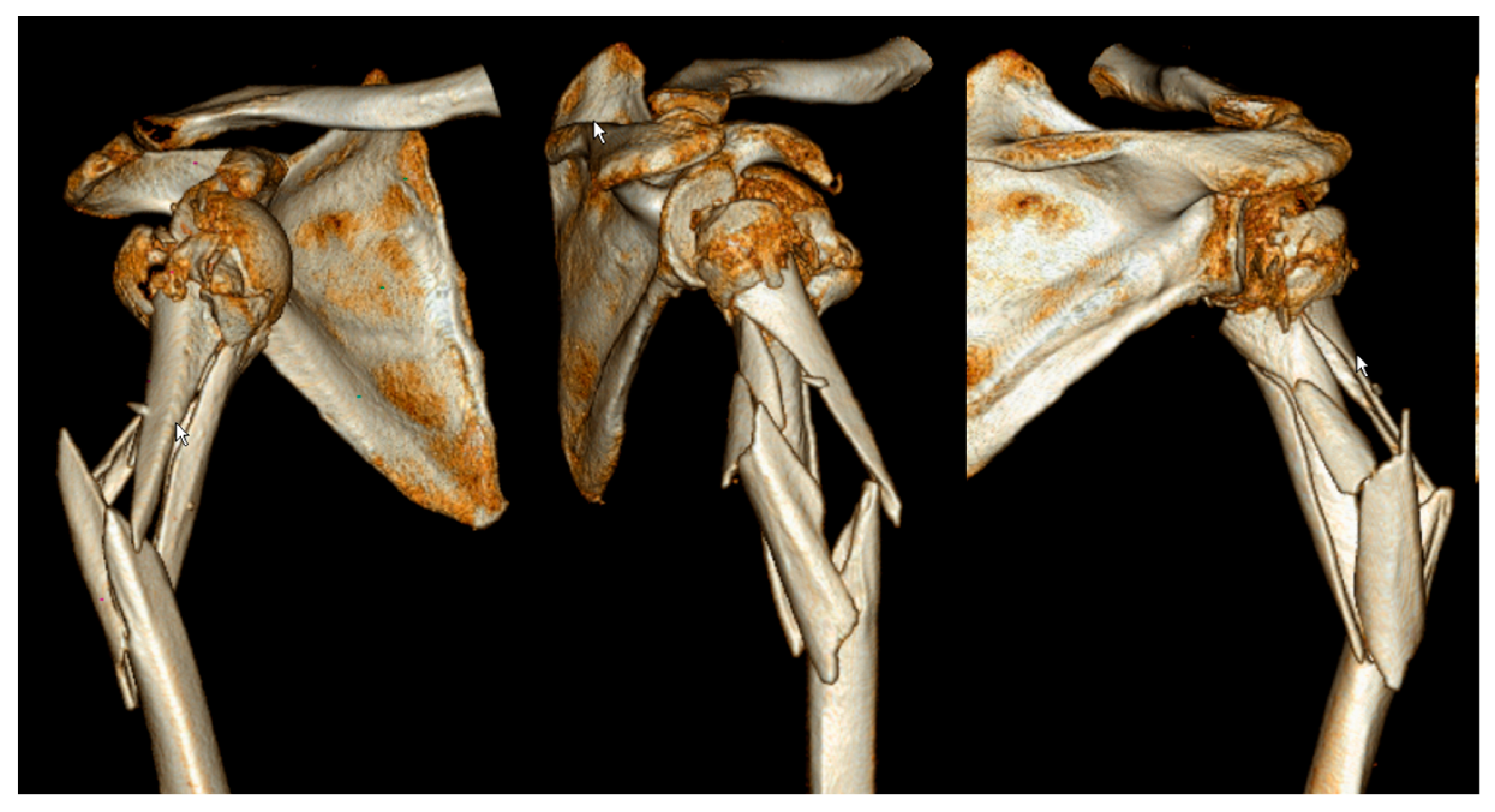 Medicina 59 00113 g002 Medicina 59 00113 g002