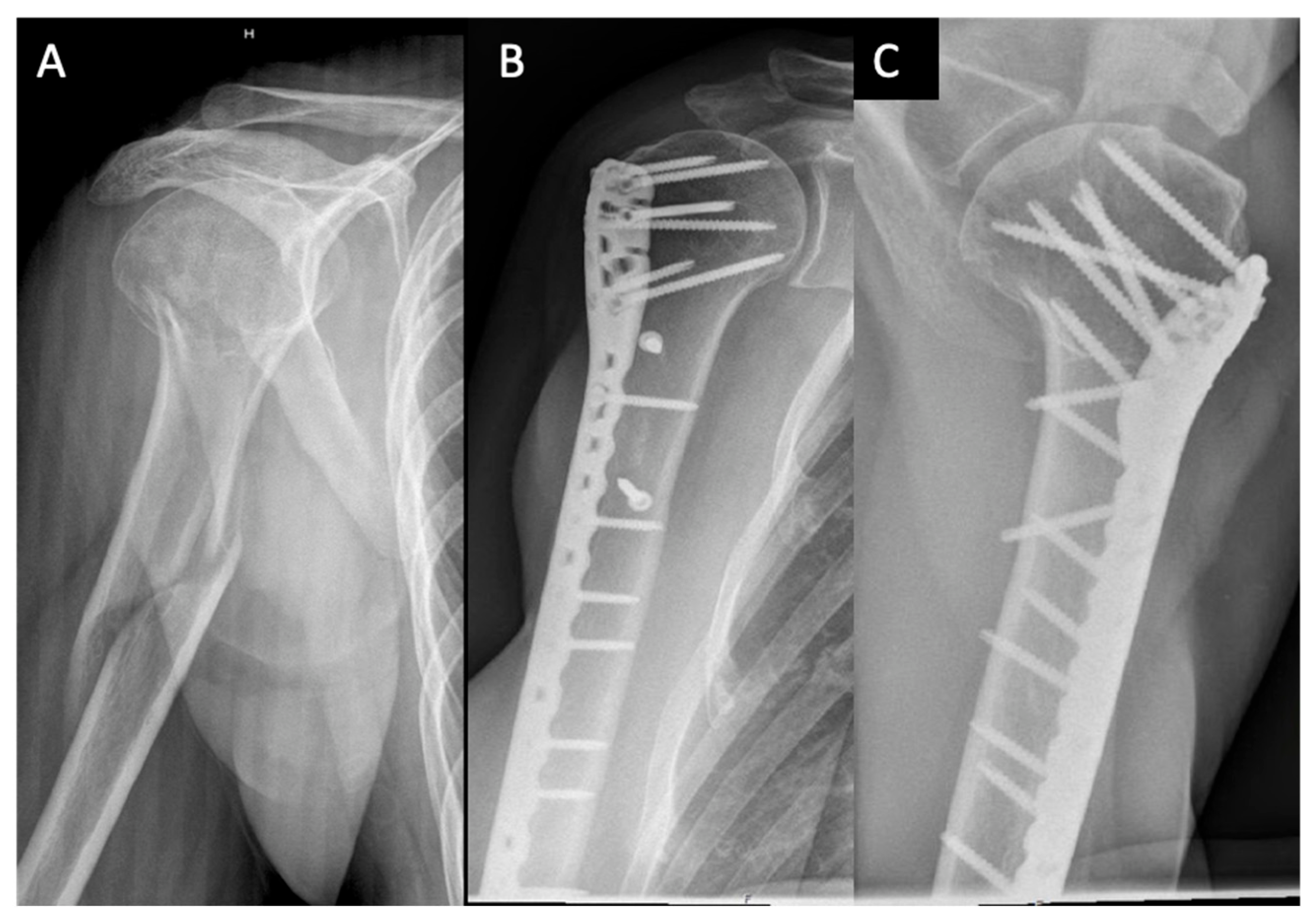 Medicina 59 00113 g004 Medicina 59 00113 g004
