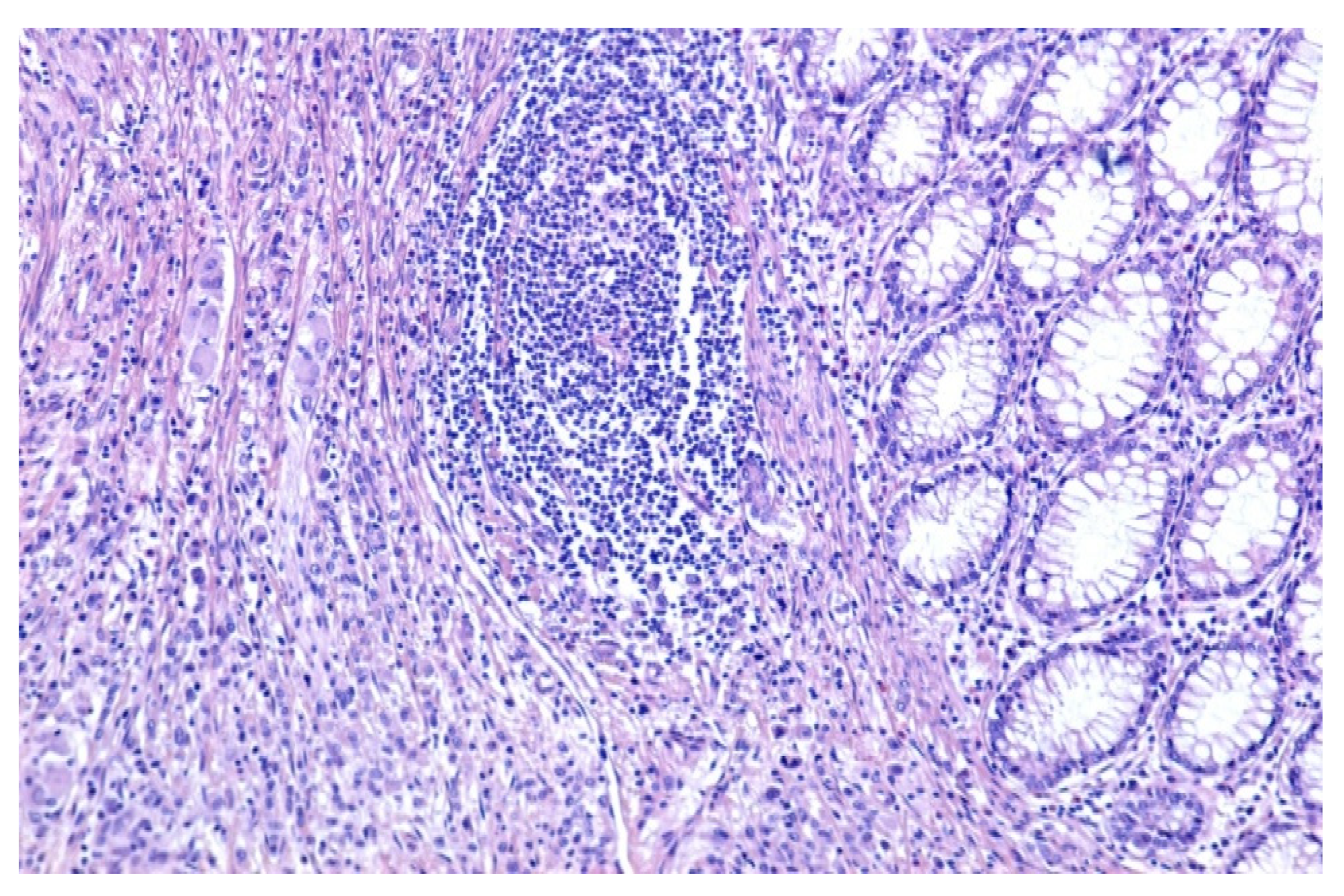 Medicina 59 00156 g002 Medicina 59 00156 g002