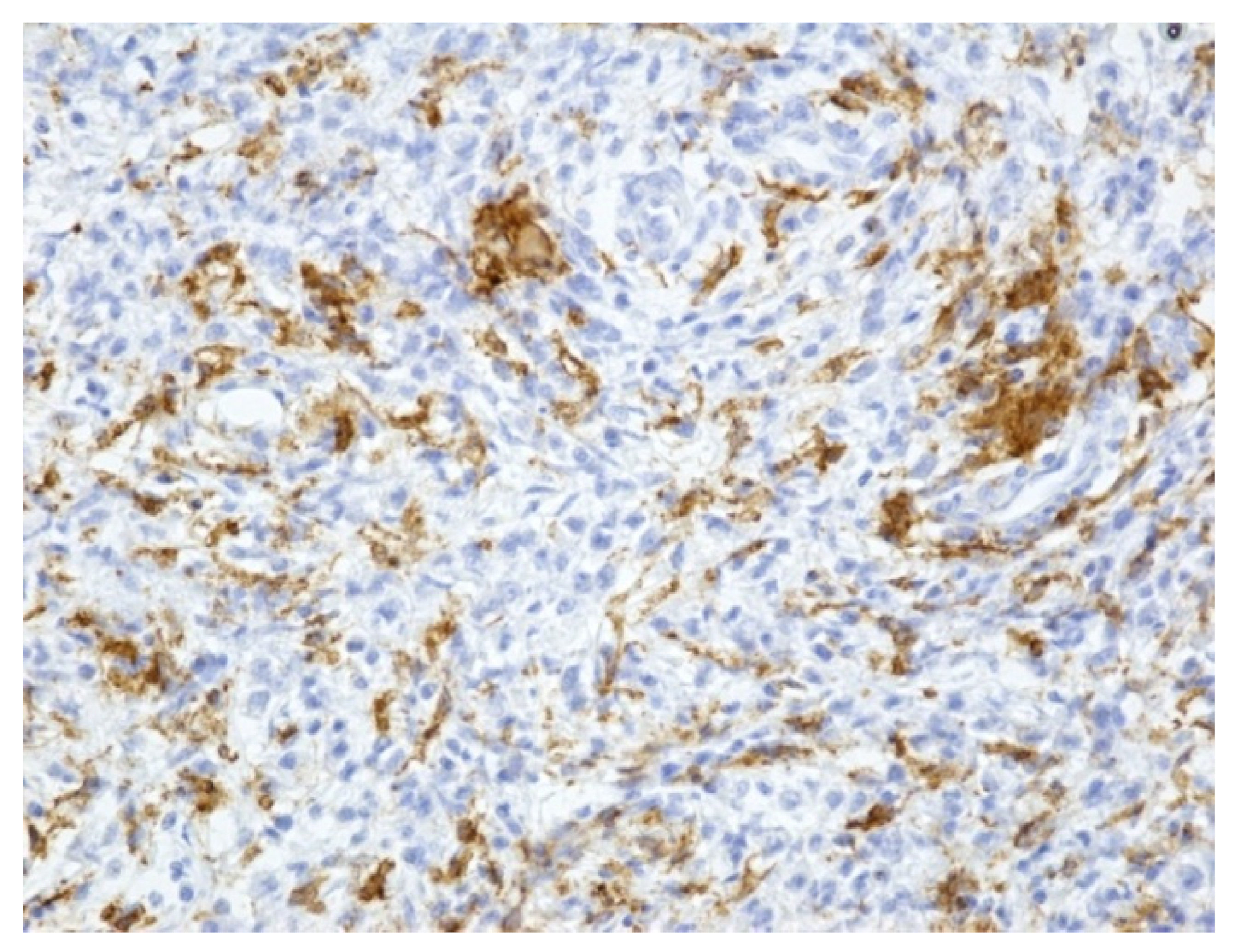 Medicina 59 00156 g005 Medicina 59 00156 g005