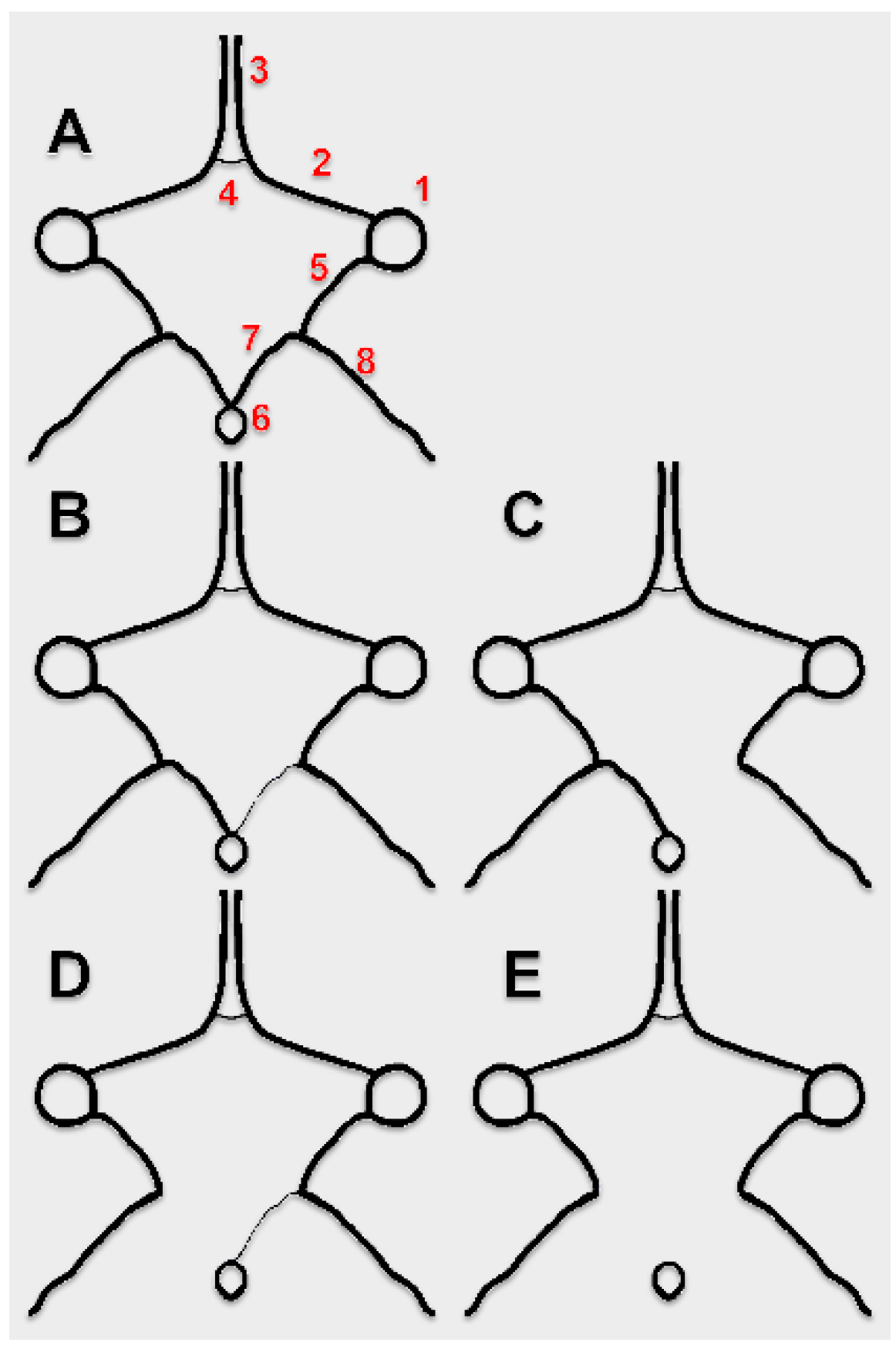 posterior cerebral artery distribution