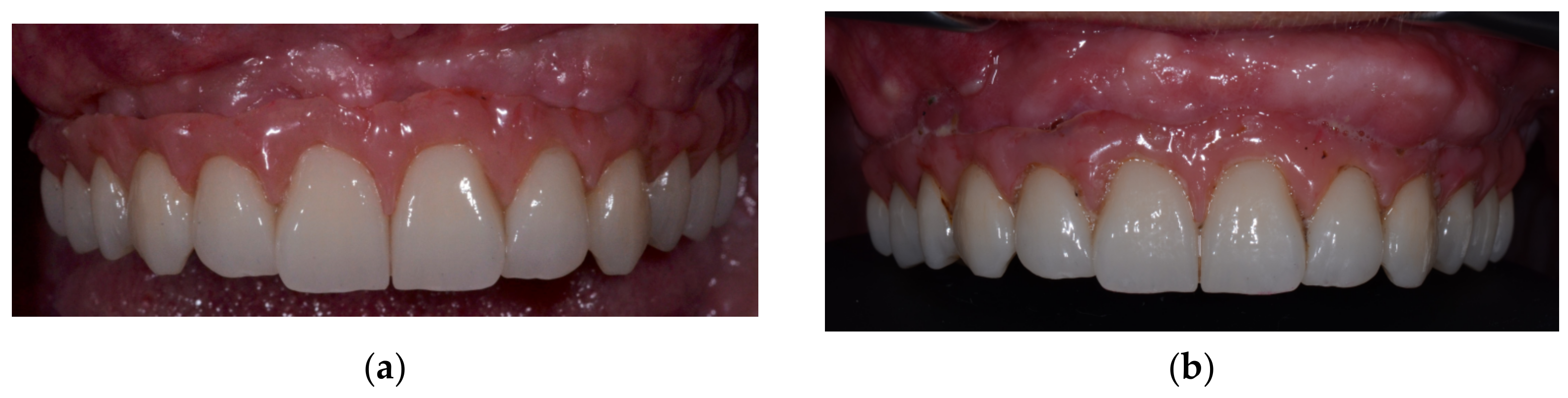 Medicina 59 00494 g002 Medicina 59 00494 g002