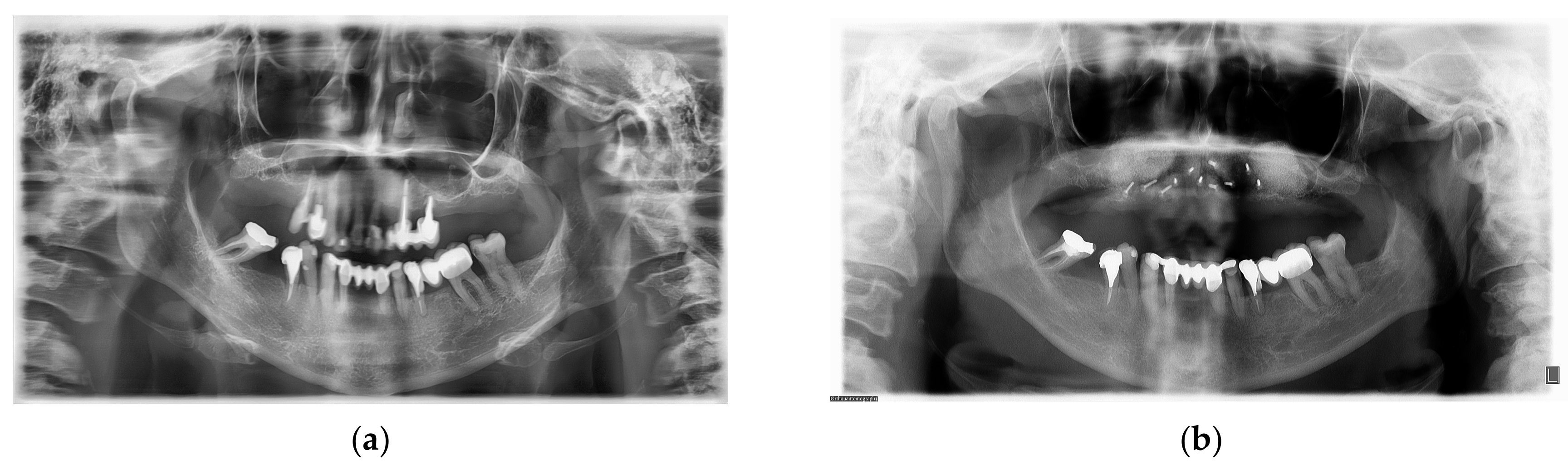 Medicina 59 00494 g003a Medicina 59 00494 g003a